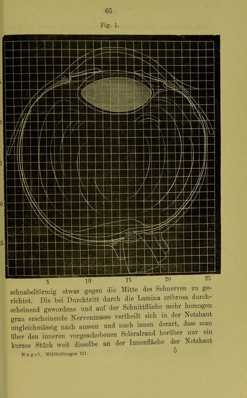 ■■■■ 5 10 15 20 25 schnabehörmig etwas gegen die Mitte des Sehnerven zu ge- richtet. Die bei Durchtritt durch die Lamina cribrosa durch- scheinend gewordene und auf der Schnittfläche mehr homogen grau erscheinende Nervenmasse vertheilt sich m der Netzhaut ungleichmässig nach aussen und nach innen derart, dass man über den inneren vorgeschobenen Scleralrand herüber nur eni kurzes Stück weit dieselbe an der Innenfläche der Netzhaut 5