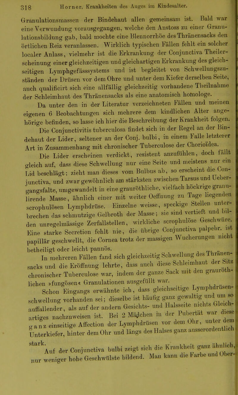 Granulationsmassen der Bindehaut allen gemeinsam ist. Bald war eine Verwundung vorausgegangen, welche den Anstcss zu einer Granu- lationsbildung gab, bald mochte eine Blennorrhoe desThränensacks den örtlichen Reiz veranlassen. Wirklich typischen Fällen fehlt ein solcher localer Anlass, vielmehr ist die Erkrankung der Conjunctiva Theiler- scheinung einer gleichzeitigen und gleichartigen Erkrankung des gleich- seitigen Lymphgefässsystems und ist begleitet von Schwellungs7Ai- ständen der Drüsen vor dem Ohre und unter dem Kiefer derselben Seite, auch qualificirt sich eine allfällig gleichzeitig vorhandene Tlieilnahme der Schleimhaut des Thränensacks als eine anatomisch homologe. Da unter den in der Literatur verzeichneten Fällen und meinen eigenen 6 Beobachtungen sich mehrere dem kindlichen Alter ange- hörige befinden, so lasse ich hier die Beschreibung der Krankheit folgen. Die Conjunctivitis tuberculosa findet sich in der Regel an der Bm- dehaut der Lider, seltener an der Conj. bulbi, in einem Falle letzterer Art in Zusammenhang mit chronischer Tuberculose der Chorioidea. Die Lider erscheinen verdickt, resistent anzufühlen, doch fallt bleich auf, dass diese Schwellung nur eine Seite und meistens nur em Lid beschlägt; zieht man dieses vom Bulbus ab, so erscheint die Con- junctiva. und zwar gewöhnlich am stärksten zwischen Tarsus und üeber- cangsfalte, umgewandelt in eine grauröthliche, vielfach höckrige granu- firende Masse, ähnlich einer mit weiter Oelfnung zu Tage liegenden scrophulösen Lymphdrüse. Einzelne weisse, speckige Stellen unter- brechen das schmutzige Gelbroth der Masse; sie sind vertieft und bil- den unregelmässige Zerfallstellen, wirkliche scrophulöse Geschwüre Eine starke Secretion fehlt nie, die übrige Conjunctiva palpebr. ist papillär geschwellt, die Cornea trotz der massigen Wucherungen nicht betheiligt oder leicht pannös. .. In mehreren Fällen fand sich gleichzeitig Schwellung des Thränen- sacks und die Eröffnung lehrte, dass auch diese Schleimhaut der hvtz chronischer Tuberculose war, indem der ganze Sack mit den graurotli- lichen »fungösen« Granulationen ausgefüllt war. Schon Eingangs erwähnte ich, dass gleichseitige Lymphdrusen- schwellung vorhanden sei; dieselbe ist häufig ganz gewaltig und unr so auffallender, als auf der andern Gesichts- und Halssei e ;cB« Gleich- artiges nachzuweisen ist. Bei 2 Mädchen in der Pubertät war diese .anz einseitige Affection der Lymphdrüsen vor dem Ohr, unter dem Unterkiefer, hinter dem Ohr und längs des Halses ganz ausserordentlich '''\uf der Coniunctiva bulbi zeigt sich die Krankheit ganz ähi^ich nur weniger hohe Geschwülste bildend. Man kann die Karbe und Ober