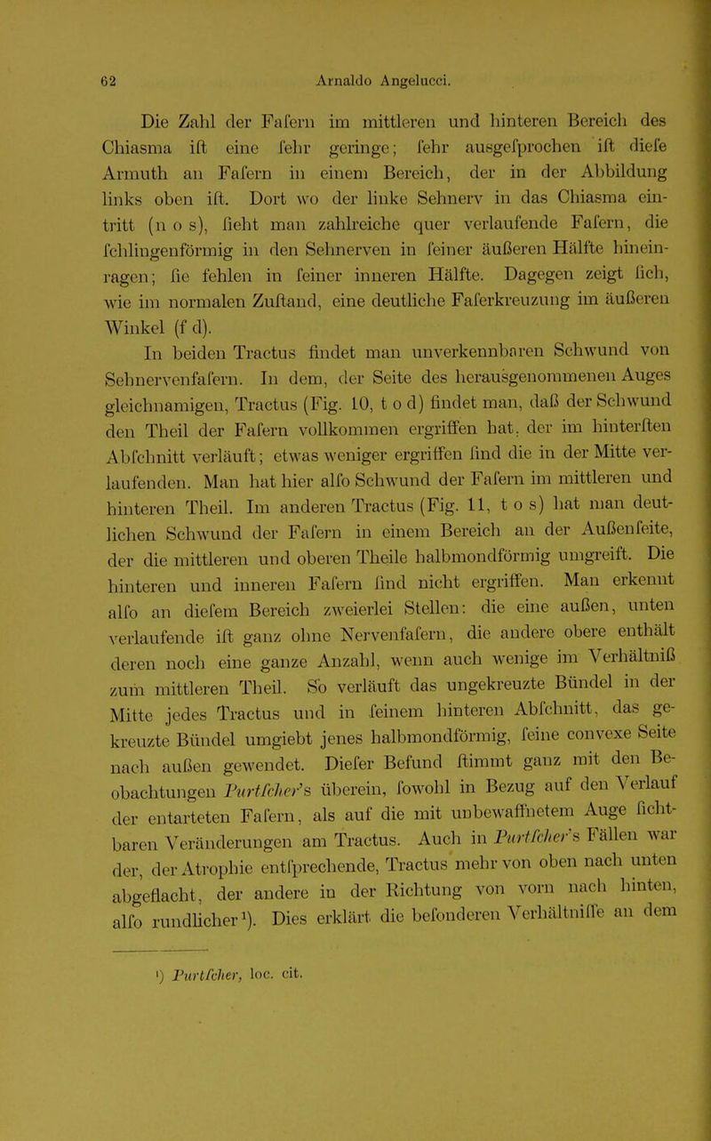 Die Zahl der Fafern im mittleren und hinteren Bereich des Chiasma ift eine lehr geringe; lehr ausgefprochen ift diefe Armuth an Fai'ern in einem Bereich, der in der Abbildung links oben ift. Dort wo der linke Sehnerv in das Chiasma ein- tritt (n o s), lieht man zahlreiche quer verlaufende Fafern, die IVhlingenförmig in den Selmerven in feiner äußeren Hälfte hinein- ragen; fie fehlen in feiner inneren Hälfte. Dagegen zeigt lieh, wie im normalen Zuftand, eine deutliche Faferkreuzung im äußeren Winkel (f d). In beiden Tractus findet man unverkennbaren Schwund von Sehnervenfafern. In dem. der Seite des herausgenommenen Auges gleichnamigen, Tractus (Fig. 10, t o d) findet man, daß der Schwund den Theil der Fafern vollkommen ergriffen hat, der im hinterften Abfchnitt verläuft; etwas weniger ergriffen lind die in der Mitte ver- laufenden. Man hat hier alfo Schwund der Fafern im mittleren und hinteren Theil. Im anderen Tractus (Fig. 11, tos) hat man deut- lichen Schwund der Fafern in einem Bereich an der Außenfeite, der die mittleren und oberen Theile halbmondförmig umgreift. Die hinteren und inneren Fafern lind nicht ergriffen. Man erkennt alfo an diefem Bereich zweierlei Stellen: die eine außen, unten verlaufende ift ganz ohne Nervenfafern, die andere obere enthält deren noch eine ganze Anzahl, wenn auch wenige im Verhältniß zum mittleren Theil. So verläuft das ungekreuzte Bündel in der Mitte jedes Tractus und in feinem hinteren Abfchnitt, das ge- kreuzte Bündel umgiebt jenes halbmondförmig, feine convexe Seite nach außen gewendet. Diefer Befund ftimmt ganz mit den Be- obachtungen PurtfcJier's überein, fowohl in Bezug auf den Verlauf der entarteten Fafern, als auf die mit unbewaffnetem Auge ficht- baren Veränderungen am Tractus. Auch in PurtfcJier's Fällen war der, der Atrophie entfprechende, Tractus mehr von oben nach unten abgeflacht, der andere in der Richtung von vorn nach hinten, alfo rundlicher1). Dies erklärt die befonderen Verhältnifie an dem ') Purtfcher, loa cit.