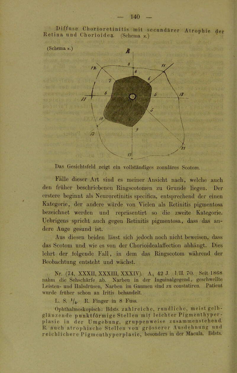 Diffuse Chorioretinitis mit sccundärer Atrophie der Retina und Chorioideg. (Schema x.) (Schema x.) » Das Gesichtsfeld zeigt ein vollständiges zonuläres Scotom. Fälle dieser Art sind es meiner Ansieht nach, welche auch den früher beschriebenen Ringscotomen zu Grunde liegen. Der erstere beginnt als Neuroretinitis speeifica, entsprechend der einen Kategorie, der andere würde von Vielen als Retinitis pigmentosa bezeichnet werden und repräsentirt so die zweite Kategorie. Uebrigens spricht auch gegen Retinitis pigmentosa, dass das an- dere Auge gesund ist. Aus diesen beiden lässt sich jedoch noch nicht beweisen, dass das Scotom und wie es von der Chorioidealatt'ection abhängt. Dies lehrt der folgende Fall, in dem das Ringscotom während der Beobachtung entsteht und wächst. Nr. (74, XXXII, XXXffl, XXXIV). A., 42 J. 111.70. Seil 1868 nahm die Sehschärfe ab. Narben in der [nguinalgegend, geschwellte Leisten- und Halsdrüsen, Narben im Gaumen sind zu constatiren. Patient winde früher schon an Iritis behandelt L S. >/4. R. Finger in 8 Fuss. Ophthalmoskopisch: Bdsts. zahlreiche, rundliche, meist gelb- glänzende punktförmige Stellen mit leichter Pigmenthyper- plasie in der Umgebung, gruppenweise zusammenstehend. M. auch atrophische Stellen von grösserer Ausdehnung und reichlichere Pigmcuthyperplasie, besonders in der Macula, ßdsts.
