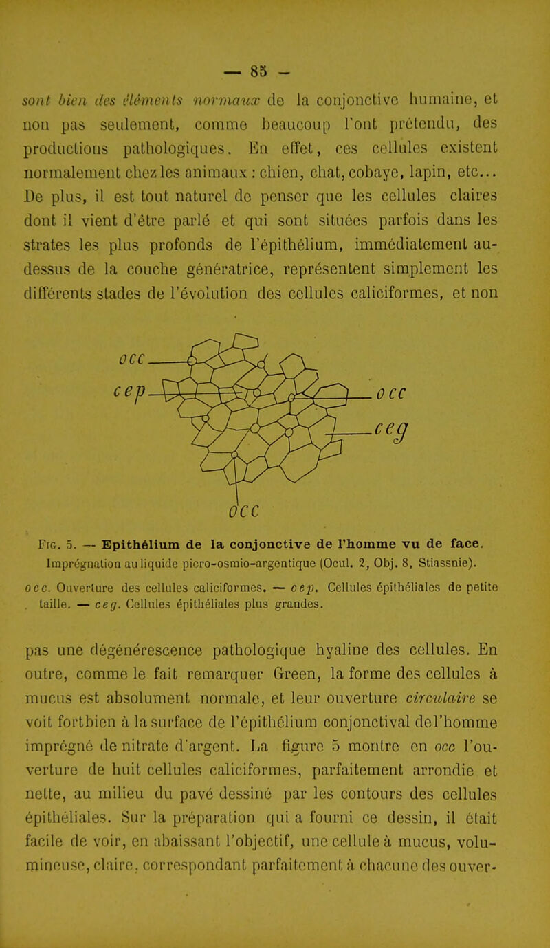 sont bien des iHémcnls normaux de la conjonctive humaine, et non pas seulement, comme beaucoup l'ont prétendu, des productions pathologiques. En effet, ces cellules existent normalement chez les animaux : chien, chat, cobaye, lapin, etc. De plus, il est tout naturel de penser que les cellules claires dont il vient d'être parlé et qui sont situées parfois dans les strates les plus profonds de l'épithélium, immédiatement au- dessus de la couche génératrice, représentent simplement les différents stades de l'évolution des cellules caliciformes, et non OCC FiG. 5. — Epithélium de la conjonctive de l'homme vu de face. Imprégnation au liquide picro-osmio-argeatique (Ocul. 2, Obj. 8, Stiassnie). OCC. Ouverture des cellules caliciformes. — cep. Cellules épilhéliales de petite . taille. — ce g. Cellules épitliéliales plus grandes. pas une dégénérescence pathologique hyaline des cellules. En outre, comme le fait remarquer Green, la forme des cellules à mucus est absolument normale, et leur ouverture circulaire se voit fortbien à la surface de l'épithélium conjonctival del'homme imprégné de nitrate d'argent. La figure 5 montre en occ l'ou- verture de huit cellules caliciformes, parfaitement arrondie et nette, au milieu du pavé dessiné par les contours des cellules épithéliales. Sur la préparation qui a fourni ce dessin, il était facile de voir, en abaissant l'objectif, une cellule à mucus, volu- mineuse, claire, correspondant parfaitement à chacune des ouver-