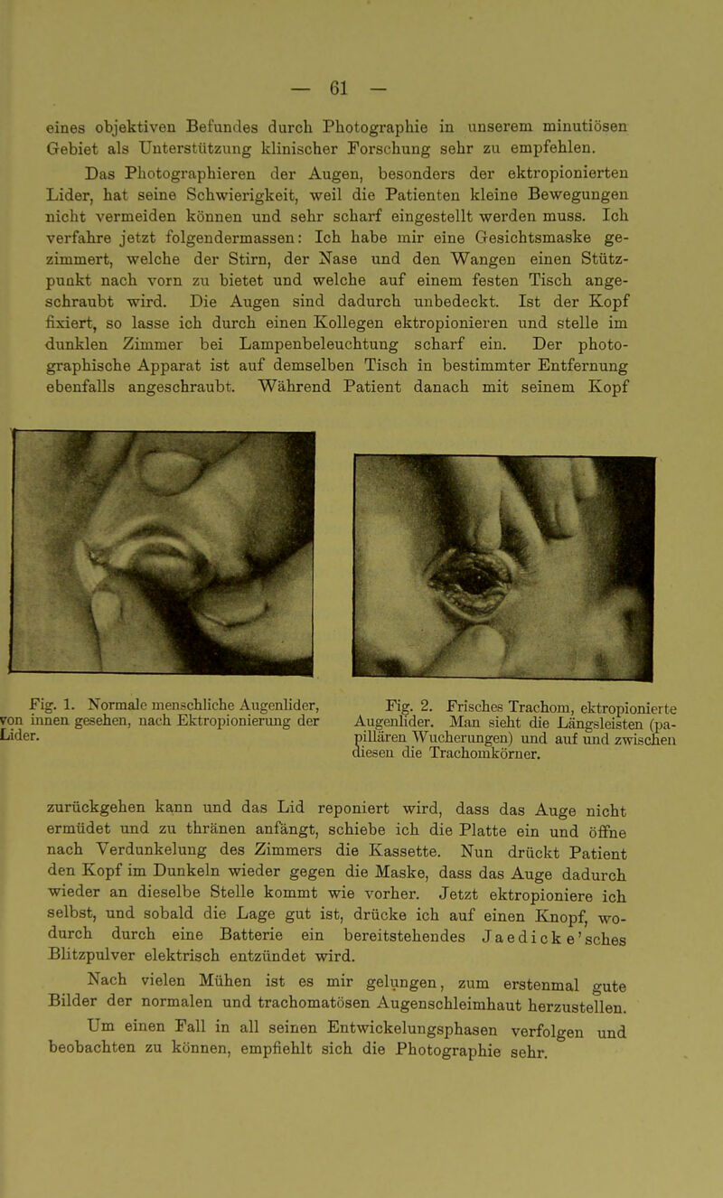 eines objektiven Befundes durch Photographie in unserem minutiösen Gebiet als Unterstützung klinischer Forschung sehr zu empfehlen. Das Photographieren der Augen, besonders der ektropionierten Lider, hat seine Schwierigkeit, weil die Patienten kleine Bewegungen nicht vermeiden können und sehr scharf eingestellt werden muss. Ich verfahre jetzt folgendermassen: Ich habe mir eine Gesichtsmaske ge- zimmert, welche der Stirn, der Nase und den Wangen einen Stütz- punkt nach vorn zu bietet und welche auf einem festen Tisch ange- schraubt wird. Die Augen sind dadurch unbedeckt. Ist der Kopf fixiert, so lasse ich durch einen Kollegen ektropionieren und stelle im dunklen Zimmer bei Lampenbeleuchtung scharf ein. Der photo- graphische Apparat ist auf demselben Tisch in bestimmter Entfernung ebenfalls angeschraubt. Während Patient danach mit seinem Kopf Fig. 1. Normale menschliche Augenlider, Fig. 2. Frisches Trachom, ektropionierte TOn innen gesehen, nach Ektropionierung der Augenlider. Man sieht die Längsleisten (pa- Lider. pillären Wucherungen) und auf und zwischen diesen die Trachomkörner. zurückgehen kann und das Lid reponiert wird, dass das Auge nicht ermüdet und zu thränen anfängt, schiebe ich die Platte ein und öffne nach Verdunkelung des Zimmers die Kassette. Nun drückt Patient den Kopf im Dunkeln wieder gegen die Maske, dass das Auge dadurch wieder an dieselbe Stelle kommt wie vorher. Jetzt ektropioniere ich selbst, und sobald die Lage gut ist, drücke ich auf einen Knopf, wo- durch durch eine Batterie ein bereitstehendes Jaedicke'sches Blitzpulver elektrisch entzündet wird. Nach vielen Mühen ist es mir gelungen, zum erstenmal gute Bilder der normalen und trachomatösen Augenschleimhaut herzustellen. Um einen Fall in all seinen Entwickelungsphasen verfolgen und beobachten zu können, empfiehlt sich die Photographie sehr.