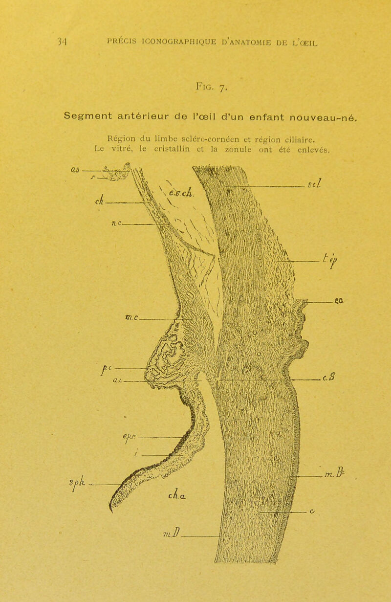 Fig. 7. Segment antérieur de l'œil d'un enfant nouveau-né. Région du limbe scléro-cornécn et région ciliairc. Le vitre, le cristallin et la zonule ont été enlevés.