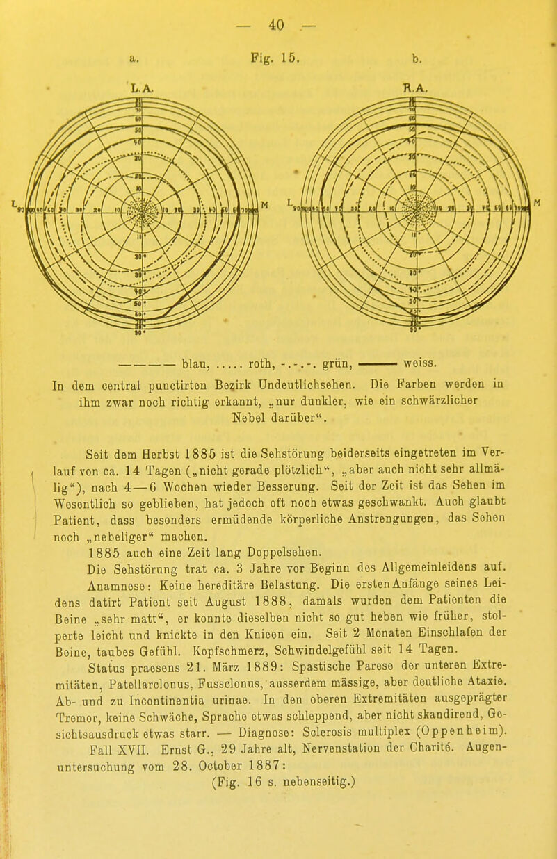Fig. 15, M L IIHH blau, roth, - grün, —— weiss. In dem central punctirten Bezirk Undeutlichsehen. Die Farben werden in ihm zwar noch richtig erkannt, „nur dunkler, wie ein schwärzlicher Nebel darüber. Seit dem Herbst 1885 ist die Sehstörung beiderseits eingetreten im Ver- lauf von ca. 14 Tagen („nicht gerade plötzlich, „aber auch nicht sehr allmä- lig), nach 4 — 6 Wochen wieder Besserung. Seit der Zeit ist das Sehen im Wesentlich so geblieben, hat jedoch oft noch etwas geschwankt. Auch glaubt Patient, dass besonders ermüdende körperliche Anstrengungen, das Sehen noch „nebeliger machen. 1885 auch eine Zeit lang Doppelsehen. Die Sehstörung trat ca. 3 Jahre vor Beginn des Allgemeinleidens auf. Anamnese: Keine hereditäre Belastung. Die ersten Anfänge seines Lei- dens datirt Patient seit August 1888, damals wurden dem Patienten die Beine .sehr matt, er konnte dieselben nicht so gut heben wie früher, stol- perte leicht und knickte in den Knieen ein. Seit 2 Monaten Einschlafen der Beine, taubes Gefühl. Kopfschmerz, Schwindelgefühl seit 14 Tagen. Status praesens 21. März 1889: Spastische Parese der unteren Extre- mitäten, Patellarclonus, Fussclonus, ausserdem mässige, aber deutliche Ataxie. Ab- und zu Incontinentia urinae. In den oberen Extremitäten ausgeprägter Tremor, keine Schwäche, Sprache etwas schleppend, aber nicht skandirend, Ge- sichtsausdruck etwas starr. — Diagnose: Sclerosis multiplex (Oppenheim). Fall XVII. Ernst G., 29 Jahre alt, Nervenstation der Charite. Augen- untersuchung vom 28. October 1887: (Fig. 16 s. nebenseitig.)