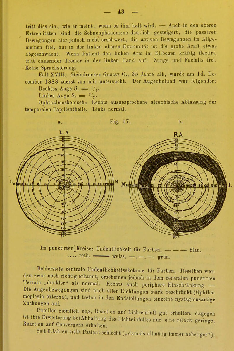 tritt dies ein, wie er meint, wenn es ihm kalt wird. — Auch in den oberen Extremitäten sind die Sehnenphänomene deutlich gesteigert, die passiven Bewegungen hier jedoch nicht erschwert, die activen Bewegungen im Allge- meinen frei, nur in der linken oberen Extremität ist die grobe Kraft etwas abgeschwächt. Wenn Patient den linken Arm im Ellbogen kräftig flectirt, tritt dauernder Tremor in der linken Hand auf. Zunge und Facialis frei. Keine Sprachstörung. Fall XVIII. Steindrucker Gustav 0., 35 Jahre alt, wurde am 14. De- cember 1888 zuerst von mir untersucht. Der Augenbefund war folgender: Reohtes Auge S. = V4- Linkes Auge S. = 2/s. Ophthalmoskopisch: Rechts ausgesprochene atrophische Ablassung der temporalen Papillentheile. Links normal. Fig. 17. LA b. RA ■—Tfl 6(1 Im punctirten:Kreise: ündeutlichkeit für Farben, blau, roth weiss, —.—. grun. Beiderseits centrale Undeutlichkeitsskotome für Farben, dieselben wer- den zwar noch richtig erkannt, erscheinen jedoch in dem centralen punctirten Terrain „dunkler« als normal. Rechts auch periphere Einschränkung. — Die Augenbewegungen sind nach allen Richtungen stark beschrankt (Ophtha- moplegia externa;, und treten in den Endstellungen einzelne nystagmusartige Zuckungen auf. Pupillen ziemlich eng, Reaction auf Lichteinfall gut erhalten, dagegen ist ihre Erweiterung bei Abhaltung des Lichteinfalles nur eine relativ geringe Reaction auf Convergenz erhalten. Seit 6 Jahren sieht Patient schlecht („damals allmälig immer nebeliger).