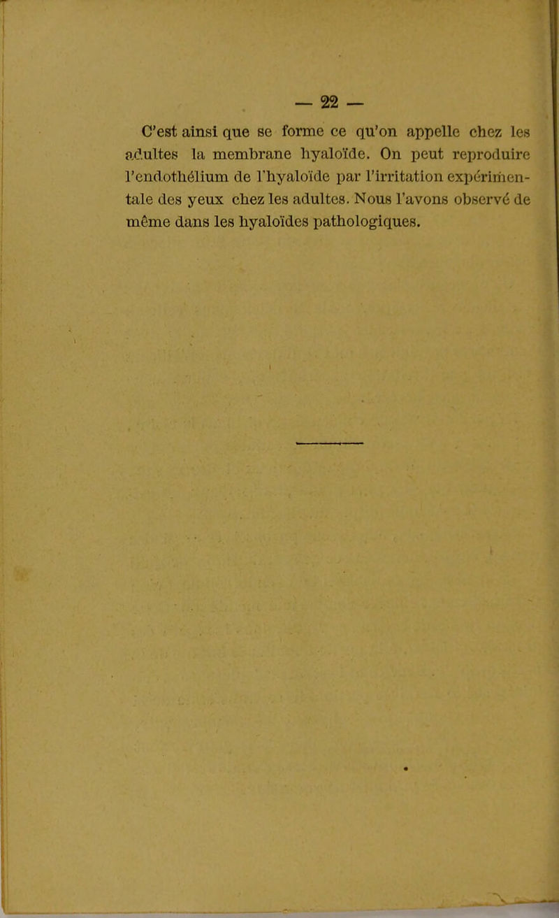C'est ainsi que se forme ce qu'on appelle chez les adultes la membrane hyaloïde. On peut reproduire l'endothélium de l'hyaloïde par l'irritation expmmcn- tale des yeux chez les adultes. Nous l'avons observé de même dans les hyaloïdes pathologiques. t