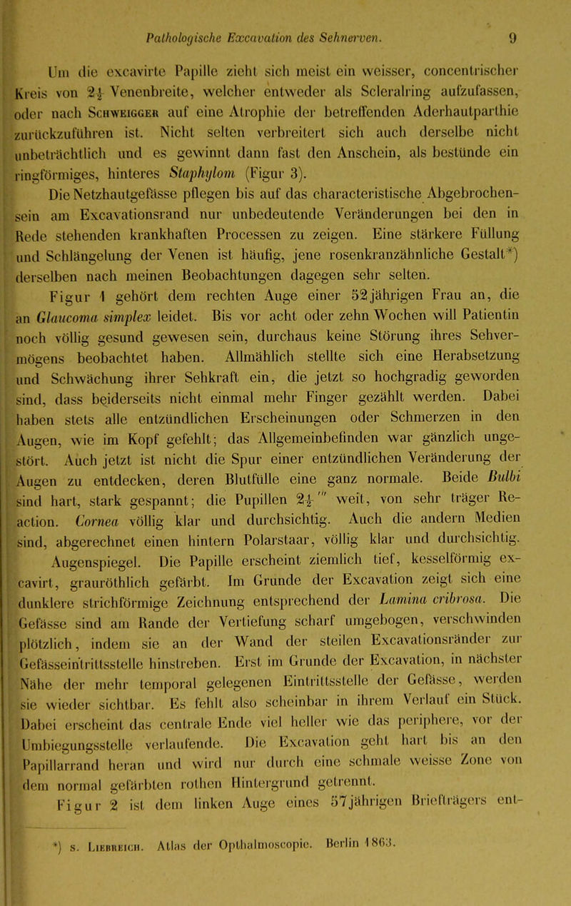 Um die excavirte Papille zieht sich meist ein weisser, concentrischer Kieis von ->>, Venenbreite, welcher entweder als Scleralring aufzufassen, oder nach Schweiggeh auf eine Atrophie der betreffenden Aderhautparthie zui iickzuführen ist. Nicht selten verbreitert sich auch derselbe nichl unbeträchtlich und es gewinnt dann fast den Anschein, als bestünde ein ringförmiges, hinteres Staphylom (Figur 3). DieNetzhautgefässe pflegen bis auf das characteristische Abgebrochen- sein am Excavationsrand nur unbedeutende Veränderungen bei den in Rede stehenden krankhaften Processen zu zeigen. Eine stärkere Füllung und Schlängelung der Venen ist häufig, jene rosenkranzähnliche Gestalt derselben nach meinen Beobachtungen dagegen sehr selten. Figur 1 gehört dem rechten Auge einer 52jährigen Frau an, die an Glaucoma dmplex leidet. Bis vor acht oder zehn Wochen will Patientin noch völlig gesund gewesen sein, durchaus keine Störung ihres Sehver- mögens beobachtet haben. Allmählich stellte sich eine Herabsetzung und Schwächung ihrer Sehkraft ein, die jetzt so hochgradig geworden sind, dass beiderseits nicht einmal mehr Finger gezählt werden. Dabei haben stets alle entzündlichen Erscheinungen oder Schmerzen in den Augen, wie im Kopf gefehlt; das Allgemeinbefinden war gänzlich unge- stört. Auch jetzt ist nicht die Spur einer entzündlichen Veränderung der Augen zu entdecken, deren Blutfülle eine ganz normale. Beide Bulbi sind hart, stark gespannt; die Pupillen weit, von sehr träger Re- action. Cornea völlig klar und durchsichtig. Auch die andern Medien sind, abgerechnet einen hintern Polarstaar, völlig klar und durchsichtig. Augenspiegel. Die Papille erscheint ziemlich tief, kesseiförmig ex- cavirt, grauröthlich gefärbt, Im Grunde der Excavation zeigt sich eine dunklere strichförmige Zeichnung entsprechend der Lamina cribrosa. Die befässe sind am Rande der Verliefung scharf umgebogen, verschwinden plötzlich, indem sie an der Wand der steilen Excavationsränder zur GefösseintrittssteUe hinslreben. Erst im Grunde der Excavation, in nächster Nähe der mehr temporal gelegenen Eintrittsstelle der Geiässe, werden si<! wieder sichtbar. Es fehlt also scheinbar in ihrem Verlauf ein Stück. Dabei erscheint das centrale Ende, viel heller wie das periphere, vor der Umlegungsstelle verlaufende. Die Excavation geht hart bis an den Papillarrand heran und wird nur durch eine schmale weiss.« Zone von dem normal gefärbten rothen Hinlergrund getrennt. Figur 2 ist dem linken Auge eines 57 jährigen Briefträgers entr *) s. Liebreich. Atlas der Opthalmoscopie. Berlin 1863.