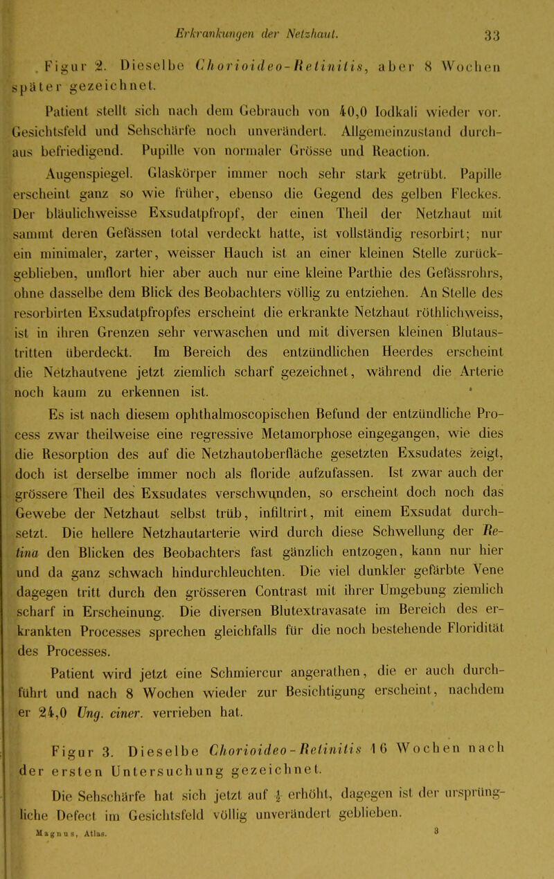 Figur 2. Dieselbe Chorioideo-Retinitis, aber 8 Wochen spüter gezeichnet. Patient stellt sich nach dem Gebrauch von 40,0 lodkali wieder vor. Gesichtsfeld und Sehschärfe noch unverändert. Allgemeinzustand durch- aus befriedigend. Pupille von normaler Grösse und Reaction. Augenspiegel. Glaskörper immer noch sehr stark getrübt. Papille erscheint ganz so wie früher, ebenso die Gegend des gelben Fleckes Der bläulichweisse Exsudatpfropf, der einen Theil der Netzhaut mit samml deren Gefässen total verdeckt hatte, ist vollständig resorbirt; nur ein minimaler, zarter, weisser Hauch ist an einer kleinen Stelle zurück- geblieben, umflort hier aber auch nur eine kleine Parthie des Gefässrohrs, ohne dasselbe dem Blick des Beobachters völlig zu entziehen. An Stelle des resorbirten Exsudatpfropfes erscheint die erkrankte Netzhaut röthlichweiss, ist in ihren Grenzen sehr verwaschen und mit diversen kleinen Blutaus- tritten überdeckt. Im Bereich des entzündlichen Heerdes erscheint die Netzhautvene jetzt ziemlich scharf gezeichnet , während die Arterie noch kaum zu erkennen ist. Es ist nach diesem ophthalmoscopischen Befund der entzündliche Pro- cess zwar theilweise eine regressive Metamorphose eingegangen, wie dies die Resorption des auf die Netzhautoberfläche gesetzten Exsudates zeigt, doch ist derselbe immer noch als floride aufzufassen. Ist zwar auch der grössere Theil des Exsudates verschwunden, so erscheint doch noch das Gewebe der Netzhaut selbst trüb, infiltrirt, mit einem Exsudat durch- setzt. Die hellere Netzhautarterie wird durch diese Schwellung der Re- tina den Blicken des Beobachters fast gänzlich entzogen, kann nur hier und da ganz schwach hindurchleuchten. Die viel dunkler gefärbte Vene dagegen tritt durch den grösseren Contrast mit ihrer Umgebung ziemlich scharf in Erscheinung. Die diversen Blutextravasate im Bereich des er- krankten Processes sprechen gleichfalls für die noch bestehende Floridität des Processes. Patient wird jetzt eine Schmiercur angerathen, die er auch durch- führt und nach 8 Wochen wieder zur Besichtigung erscheint, nachdem er 24,0 Ung. einer, verrieben hat. Figur 3. Dieselbe Chorioideo - Retinitis 16 Wochen nach der ersten Untersuchung gezeichnet. Die Sehschärfe hat sich jetzt auf \ erhöht, dagegen isl der ursprüng- , liehe Defecl im Gesichtsfeld völlig unverändert geblieben. Magnus, Atlas. 3