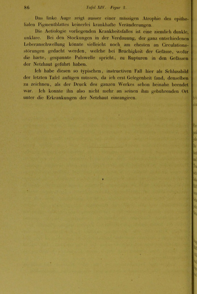 Das linke Auge zeigt ausser einer massigen Atrophie des epithe lialen Pigmentblattes keinerlei krankhafte Veränderungen. Die Aetiologie vorliegenden Krankheitsfalles ist eine ziemlich dunkle, unklare. Bei den Stockungen in der Verdauung, der ganz entschiedenen Leberanschwellung könnte vielleicht noch am ehesten an Circulations- stöiungen gedacht werden, welche bei Brüchigkeit der Gefasse, wofür die harte, gespannte Pulswelle spricht, zu Rupturen in den GePässen der Netzhaut geführt haben. Ich habe diesen so typischen, instructiven Fall hier als Schlussbild der letzten Tafel anfügen müssen, da ich erst Gelegenheit fand, denselben zu zeichnen, als der Druck des ganzen Werkes schon beinahe beendet war. Ich konnte ihn also nicht mehr an seinen ihm gebührenden Ort unter die Erkrankungen der Netzhaut einrangiren.