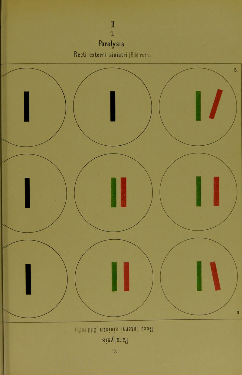 II. 1. Paralysis Recti externi sinistri (Biid roth.) (qioj p|ig)ij;siuis iuJ9:iui