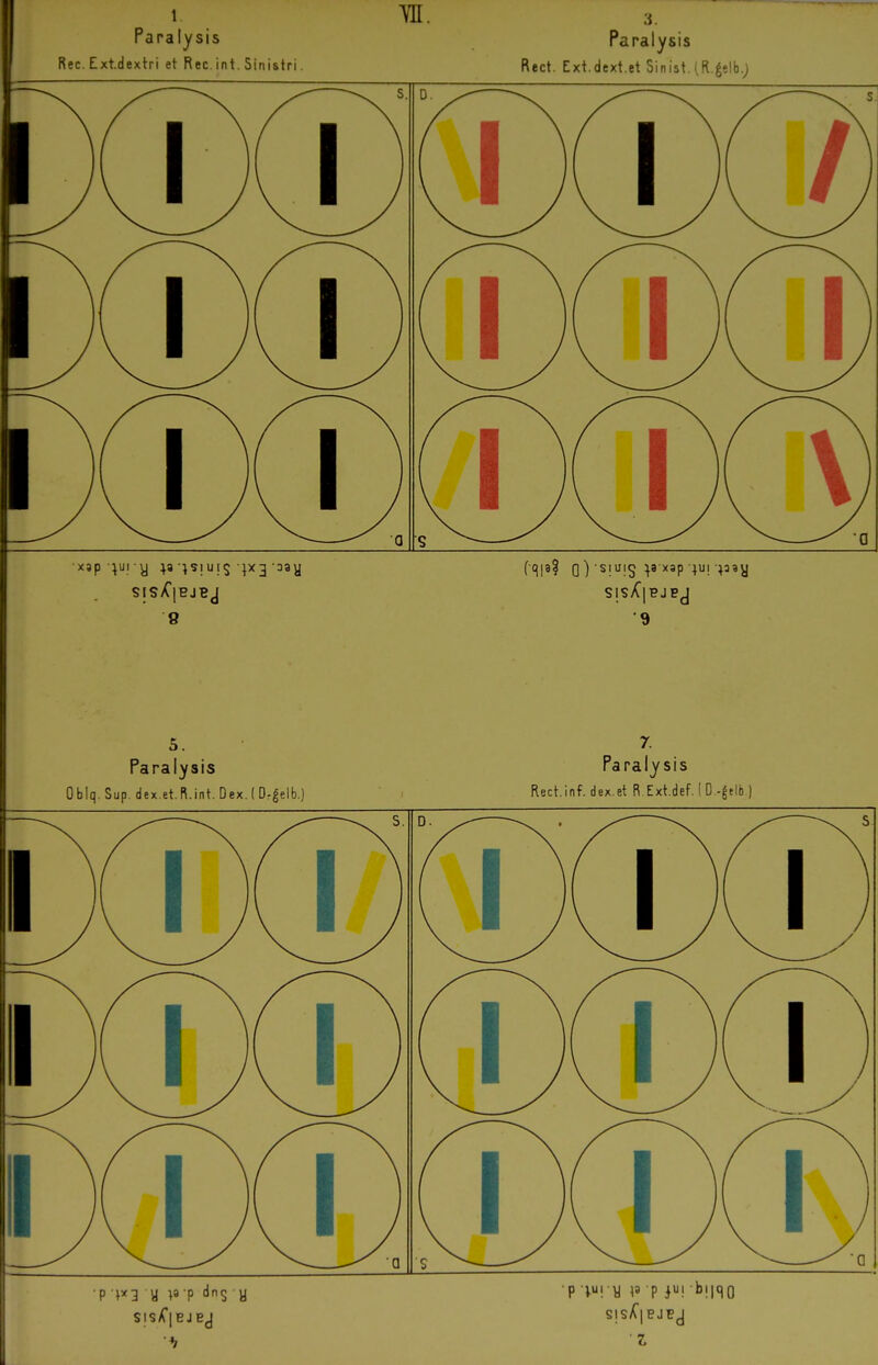 Ree. Ext.dextri et Ree. int. Sinistri. ■vn. Rect. Exi.dext.et Sinist. (R.|elb.j S. D a s xjp-^ui y ^8 ^siUI5 • aay 8 •9 Paralysis Obiq. Sup. dex.et.R.int. Dex. ( Dr^elb.) 7. Paralysis Rect.inf. dex.et R.Ext.def. ( D.-§elb ) P V! y \^ P ^W^Q SlsX|PJEJ