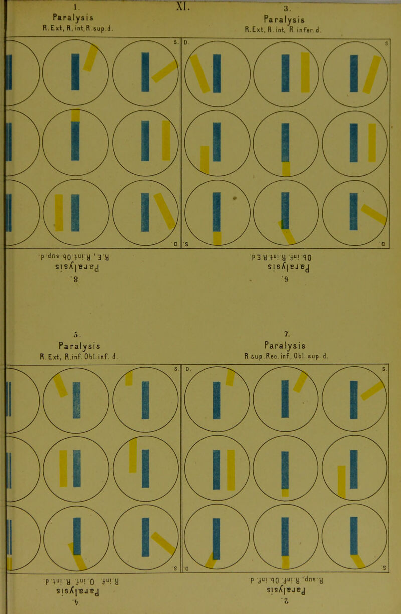 AI. Paralysis R. Ext, R, int, R sup.d. •p dns qoi^i y 'm 8 3. Paralysis R.Ext. R.int, R infer.d. SISX|BJBJ •9 5. Paralysis R.Ext, R.inf. Obl.inf. d. Pli y i! 0 i! y Paralysis R sup.Rec. inf, Ob!, sup. d. •p i! '90 i! y '«^ns y SlsX'|BJBj