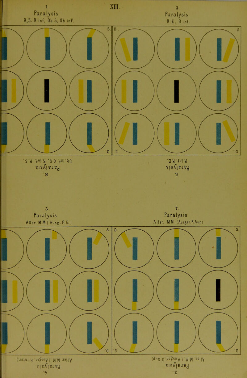 Paral^sis R,S. R inf, Ob S, Ob inf. Xlll s y 'i! y 's 0 iui qo 8 Paralysis R E, R inl. 1 yy •9 5. Paralysis Aller M Wl ( Aus^R.E I Paralysis Aller. MM (Ausgen.R.SupJ