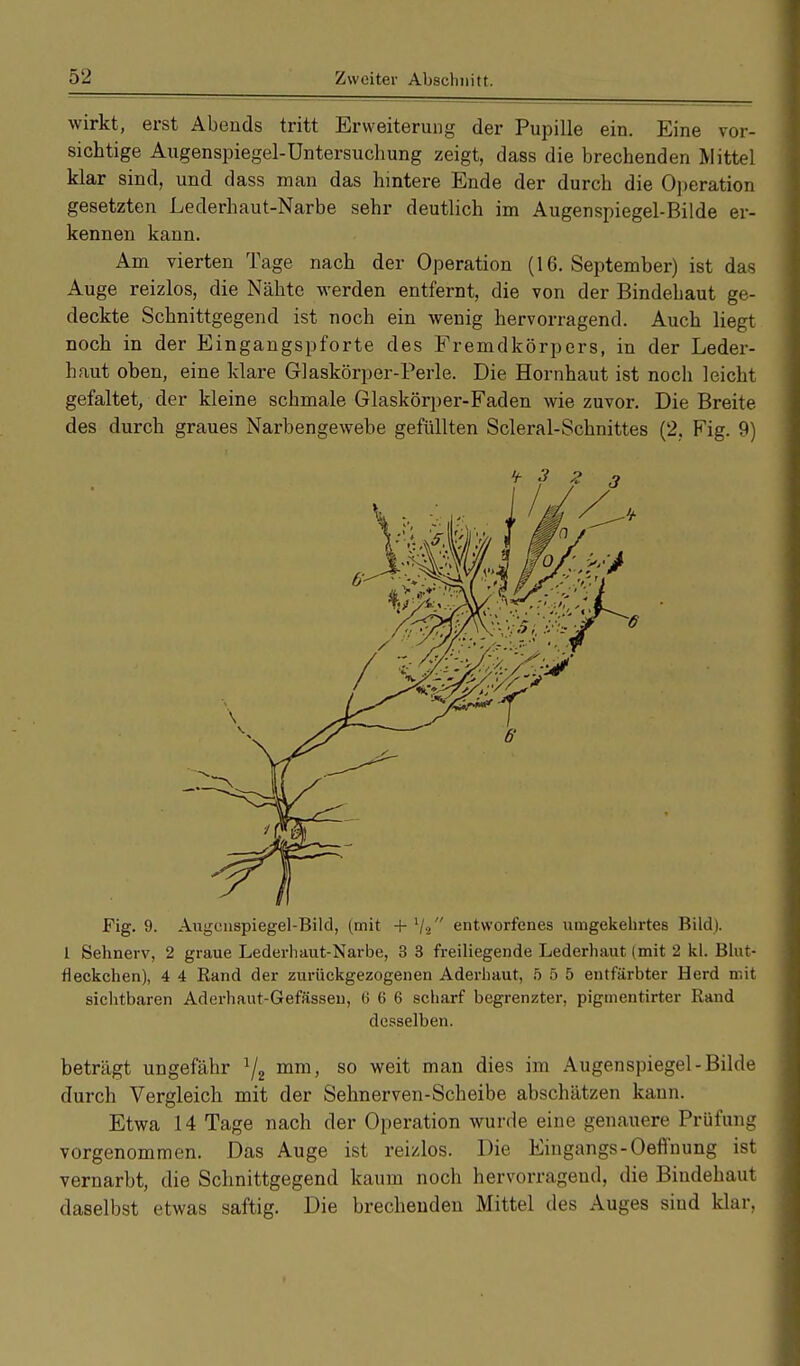 wirkt, erst Abends tritt Erweiterung der Pupille ein. Eine vor- sichtige Augenspiegel-Untersuchung zeigt, dass die brechenden Mittel klar sind, und dass man das hintere Ende der durch die Operation gesetzten Lederhaut-Narbe sehr deutlich im Augenspiegel-Bilde er- kennen kann. Am vierten Tage nach der Operation (16. September) ist das Auge reizlos, die Nähte werden entfernt, die von der Bindebaut ge- deckte Schnittgegend ist noch ein wenig hervorragend. Auch liegt noch in der Eingangspforte des Fremdkörpers, in der Leder- haut oben, eine klare Glaskörper-Perle. Die Hornhaut ist noch leicht gefaltet, der kleine schmale Glaskörper-Faden wie zuvor. Die Breite des durch graues Narbengewebe gefüllten Scleral-Schnittes (2. Fig. 9) Fig. 9. Augenspiegel-Bild, (mit + '/•/' entworfenes umgekehrtes Bild). 1 Sehnerv, 2 graue Lederhaut-Narbe, 3 3 freiliegende Lederhaut (mit 2 kl. Blut- rleckchen), 4 4 Rand der zurückgezogenen Aderhaut, 5 5 5 entfärbter Herd mit sichtbaren Aderhaut-Gefässen, 6 6 6 scharf begrenzter, pigmentirter Rand desselben. beträgt ungefähr 1/2 mm, so weit man dies im Augenspiegel-Bilde durch Vergleich mit der Sehnerven-Scheibe abschätzen kann. Etwa 14 Tage nach der Operation wurde eine genauere Prüfung vorgenommen. Das Auge ist reizlos. Die Eingangs-Oeffnung ist vernarbt, die Schnittgegend kaum noch hervorragend, die Bindehaut daselbst etwas saftig. Die brechenden Mittel des Auges sind klar,