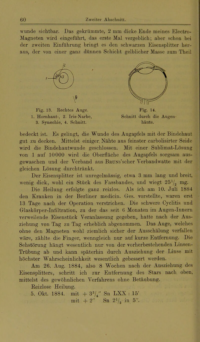 wunde sichtbar. Das gekrümmte, 2 mm dicke Ende meines Electro- Magneten wird eingeführt, das erste Mal vergeblich; aber schon bei der zweiten Einführung bringt es den schwarzen Eisensplitter her- aus, der von einer ganz dünnen Schicht gelblicher Masse zum Theil Fig. 13. Hechtes Äuge. Fig. 14. 1. Hornhaut-, 2. Iris-Narbe, Schnitt durch die Augen- 3. Synechie, 4. Schnitt. häute. bedeckt ist. Es gelingt, die Wunde des Augapfels mit der Bindehaut gut zu decken. Mittelst einiger. Nähte aus feinster carbolisirter Seide wird die Bindehautwunde geschlossen. Mit einer Sublimat-Lösung von 1 auf 10000 wird die Oberfläche des Augapfels sorgsam aus- gewaschen und der Verband aus Buhns'scher Verbandwatte mit der gleichen Lösung durchtränkt. Der Eisensplitter ist unregelmässig, etwa 3 mm lang und breit, wenig dick, wohl ein Stück des Fassbandes, und wiegt 25*/2 mg. Die Heilung erfolgte ganz reizlos. Als ich am 10. Juli 1884 den Kranken in der Berliner medicin. Ges. vorstellte, waren erst 13 Tage nach der Operation verstrichen. Die schwere Cyclitis und Glaskörper-Infiltration, zu der das seit 6 Monaten im Augen-Innern verweilende Eisenstück Veranlassung gegeben, hatte nach der Aus- ziehung von Tag zu Tag erheblich abgenommen. Das Auge, welches ohne den Magneten wohl ziemlich sicher der Ausschälung verfallen wäre, zählte die Finger, wenngleich nur auf kurze Entfernung. Die Sehstörung hängt wesentlich nur von der vorherbestehenden Linsen- Trübung ab und kann späterhin durch Ausziehung der Linse mit höchster Wahrscheinlichkeit wesentlich gebessert werden. Am 26. Aug. 1884, also 8 Wochen nach der Ausziehung des Eisensplitters, schritt ich zur Entfernung des Stars nach oben, mittelst des gewöhnlichen Verfahrens ohne Betäubung. Reizlose Heilung. 5. Okt. 1884. mit + 33/4 Sn LXX : 15' mit + 2 Sn 21/, in 5.