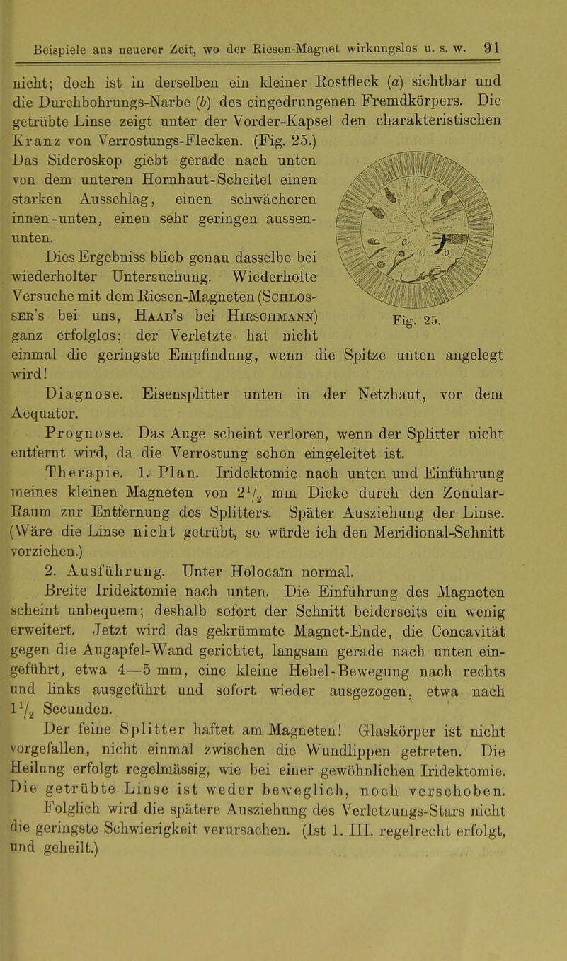 nicht; doch ist in derselben ein kleiner Rostfleck (a) sichtbar und die Durchbohrungs-Narbe (b) des eingedrungenen Fremdkörpers. Die getrübte Linse zeigt unter der Vorder-Kapsel den charakteristischen Kranz von Verrostungs-Flecken. (Fig. 25.) Das Sideroskop giebt gerade nach unten von dem unteren Hornhaut-Scheitel einen starken Ausschlag, einen schwächeren innen-unten, einen sehr geringen aussen- unten. Dies Ergebniss blieb genau dasselbe bei wiederholter Untersuchung. Wiederholte Versuche mit dem Riesen-Magneten (Schlös- see's bei uns, Haab's bei Hieschmann) Fig> 25. ganz erfolglos; der Verletzte hat nicht einmal die geringste Empfindung, wenn die Spitze unten angelegt wird! Diagnose. Eisensplitter unten in der Netzhaut, vor dem Aequator. Prognose. Das Auge scheint verloren, wenn der Splitter nicht entfernt wird, da die Verrostung schon eingeleitet ist. Therapie. 1. Plan. Iridektomie nach unten und Einführung meines kleinen Magneten von 2lj2 mm Dicke durch den Zonular- Raum zur Entfernung des Splitters. Später Ausziehung der Linse. (Wäre die Linse nicht getrübt, so würde ich den Meridional-Schnitt vorziehen.) 2. Ausführung. Unter Holocaln normal. Breite Iridektomie nach unten. Die Einführung des Magneten scheint unbequem; deshalb sofort der Schnitt beiderseits ein wenig erweitert. Jetzt wird das gekrümmte Magnet-Ende, die Concavität gegen die Augapfel-Wand gerichtet, langsam gerade nach unten ein- geführt, etwa 4—5 mm, eine kleine Hebel-Bewegung nach rechts und links ausgeführt und sofort wieder ausgezogen, etwa nach 1^2 Secunden. Der feine Splitter haftet am Magneten! Glaskörper ist nicht vorgefallen, nicht einmal zwischen die Wundlippen getreten. Die Heilung erfolgt regelmässig, wie bei einer gewöhnlichen Iridektomie. Die getrübte Linse ist weder beweglich, noch verschoben. Folglich wird die spätere Ausziehung des Verletzungs-Stars nicht die geringste Schwierigkeit verursachen. (Ist 1. III. regelrecht erfolgt, und geheilt.)