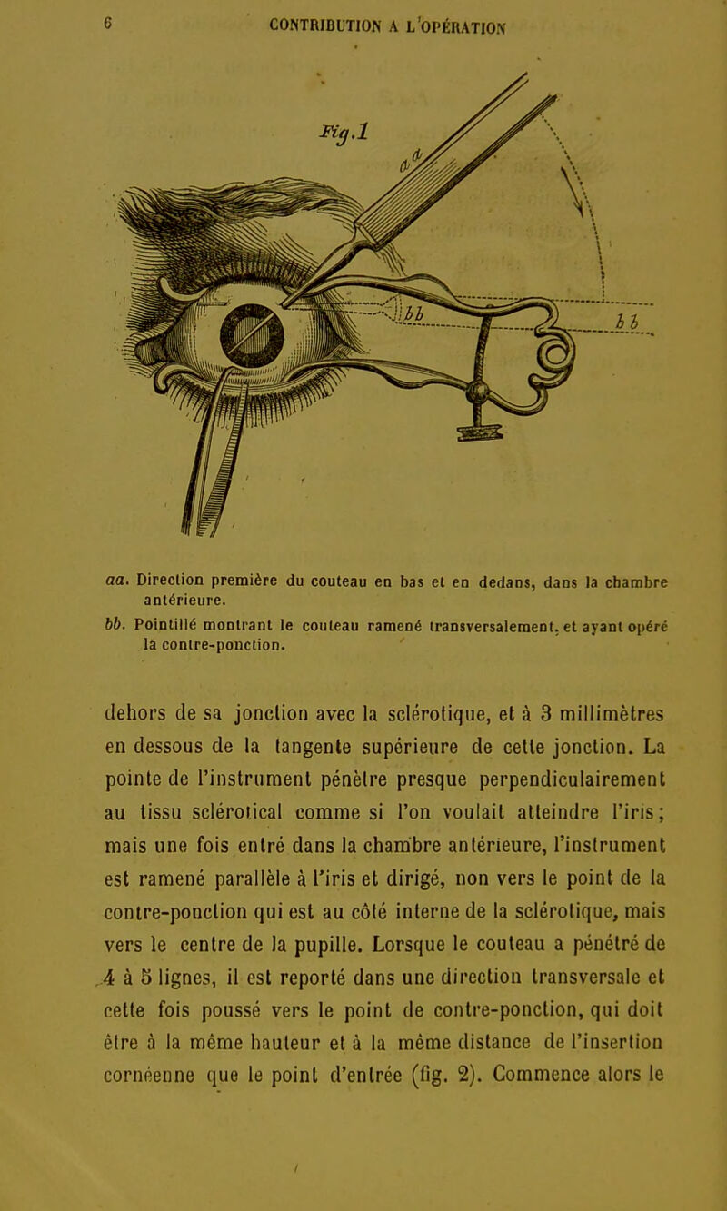 aa. Direction première du couteau en bas et en dedans, dans la chambre antérieure. bb. Pointillé montrant le couteau ramené transversalement, et ayant opéré la contre-ponction. dehors de sa jonction avec la sclérotique, et à 3 millimètres en dessous de la tangente supérieure de celle jonclion. La pointe de l'instrument pénètre presque perpendiculairement au tissu scléroiical comme si l'on voulait atteindre l'iris; mais une fois entré dans la chambre antérieure, l'instrument est ramené parallèle à l'iris et dirigé, non vers le point de la contre-ponction qui est au côté interne de la sclérotique, mais vers le centre de la pupille. Lorsque le couteau a pénétré de .4 à 5 lignes, il est reporté dans une direction transversale et cette fois poussé vers le point de contre-ponction, qui doit être à la même hauteur et à la même distance de l'insertion cornéenne que le point d'entrée (fig. 2). Commence alors le