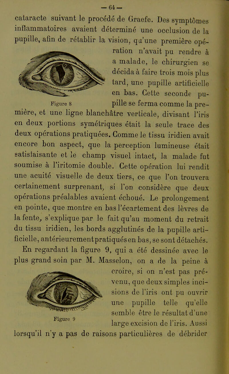 cataracte suivant le procédé de Graefe. Des symptômes inflammatoires avaient déterminé une occlusion de la pupille, afin de rétablir la vision, qu'une première opé- ^^m^^^ ration n'avait pu rendre à ^^^^^^^^^^^^^^ en bas.' Cette ' second'e pu- Figure 8 pille se ferma comme la pre- mière, et une ligne blanchâtre verticale, divisant l'iris en deux portions symétriques était la seule trace des deux opérations pratiquées. Gomme le tissu iridien avait encore bon aspect, que la perception lumineuse était satisfaisante et le champ visuel intact, la malade fut soumise à l'iritomie double. Cette opération lui rendit une acuité visuelle de deux tiers, ce que l'on trouvera certainement surprenant, si l'on considère que deux opérations préalables avaient échoué. Le prolongement en pointe, que montre en bas l'écartement des lèvres de la fente, s'explique par le fait qu'au moment du retrait du tissu iridien, les bords agglutinés de la pupille arti- ficielle, antérieurementpratiquésen bas, se sont détachés. En regardant la figure 9, qui a été dessinée avec le plus grand soin par M, Masselon, on a de la peine à croire, si on n'est pas pré- venu, que deux simples inci- sions de l'iris ont pu ouvrir une pupille telle qu'elle semble être le résultat d'une Figure 9 , • • j i>- • a • large excision de 1 iris. Aussi lorsqu'il n'y a pas de raisons particulières de débrider