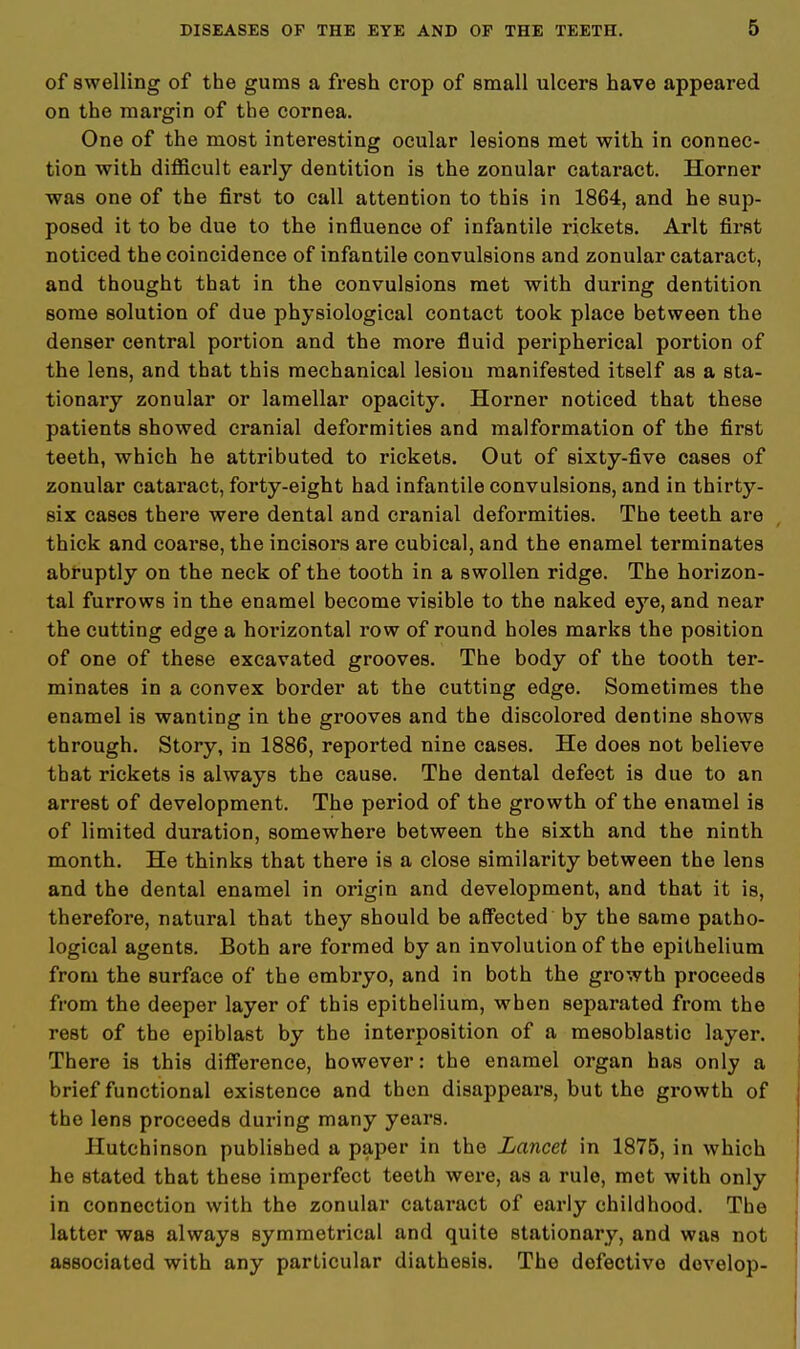 of swelling of the gums a fresh crop of small ulcers have appeared on the margin of the cornea. One of the most interesting ocular lesions met with in connec- tion with difficult early dentition is the zonular cataract. Horner was one of the first to call attention to this in 1864, and he sup- posed it to be due to the influence of infantile rickets. Arlt first noticed the coincidence of infantile convulsions and zonular cataract, and thought that in the convulsions met with during dentition some solution of due physiological contact took place between the denser central portion and the more fluid peripherical portion of the lens, and that this mechanical lesion manifested itself as a sta- tionary zonular or lamellar opacity. Horner noticed that these patients showed cranial deformities and malformation of the first teeth, which he attributed to rickets. Out of sixty-five cases of zonular cataract, forty-eight had infantile convulsions, and in thirty- six cases there were dental and cranial deformities. The teeth are thick and coarse, the incisors are cubical, and the enamel terminates abruptly on the neck of the tooth in a swollen ridge. The horizon- tal furrows in the enamel become visible to the naked eye, and near the cutting edge a horizontal row of round holes marks the position of one of these excavated grooves. The body of the tooth ter- minates in a convex border at the cutting edge. Sometimes the enamel is wanting in the grooves and the discolored dentine shows through. Story, in 1886, reported nine cases. He does not believe that rickets is always the cause. The dental defect is due to an arrest of development. The period of the growth of the enamel is of limited duration, somewhere between the sixth and the ninth month. He thinks that there is a close similarity between the lens and the dental enamel in origin and development, and that it is, therefore, natural that they should be affected by the same patho- logical agents. Both are formed by an involution of the epithelium from the surface of the embryo, and in both the growth proceeds from the deeper layer of this epithelium, when separated from the rest of the epiblast by the interposition of a mesoblastic layer. There is this difference, however: the enamel organ has only a brief functional existence and then disappears, but the growth of the lens proceeds during many years. Hutchinson published a paper in the Lancet in 1875, in which he stated that these imperfect teeth were, as a rule, met with only in connection with the zonular cataract of early childhood. The latter was always symmetrical and quite stationary, and was not associated with any particular diathesis. The defective develop-