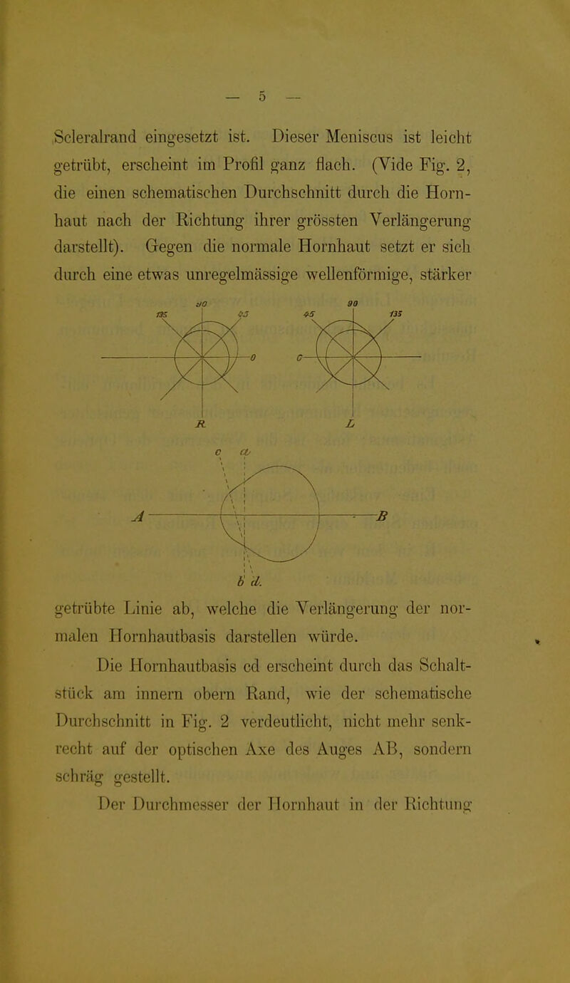 Scleralrand eingesetzt ist. Dieser Meniscus ist leicht getrübt, erscheint im Profil ganz flach. (Vide Fig. 2, die einen schematischen Durchschnitt durch die Horn- haut nach der Richtung ihrer grössten Verlängeruno' darstellt). Gegen die normale Hornhaut setzt er sich durch eine etwas unregelmässig'e wellenförmige, stärker Ä L O Cü b d. getrübte Linie ab, welche die Verlängerung der nor- malen Hornhautbasis darstellen würde. Die Ilornhautbasis cd erscheint durch das Schalt- stück am innern obern Rand, wie der schematische Durchschnitt in Fig. 2 verdeutlicht, nicht mehr senk- recht auf der optischen Axe des Auges AB, sondern schräg gestellt. Der Durchmesser der Hornhaut in der Richtung