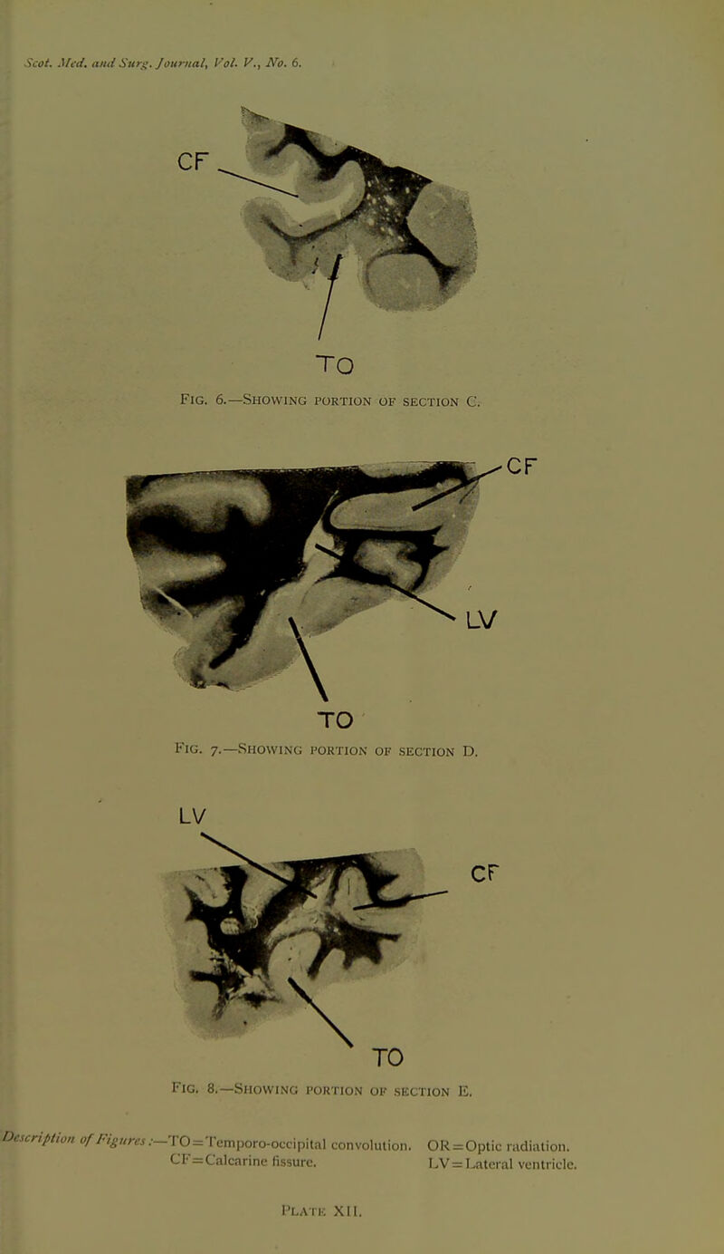 LV Fic. 8.—Showing portion of section E. Description of Figures .■-TO=Tcmporo-occipital convolution. OR = Optic nidialion. CF=CaIcarine fissure. LV = Lateral ventricle. Platk XII.