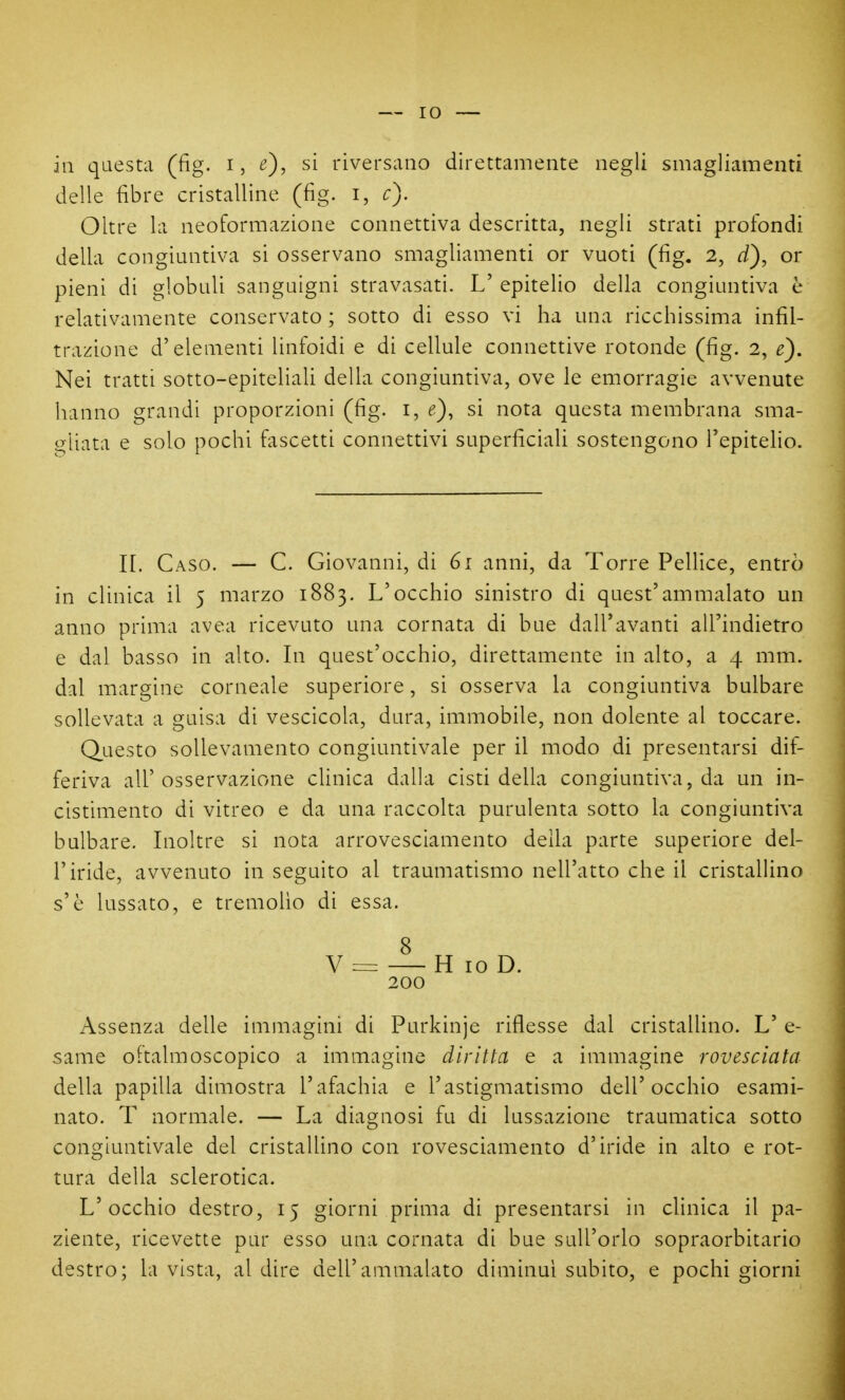 in questa (fig. i, e), si riversano direttamente negli smagliamenti delle fibre cristalline (fig. i, c). Oltre la neoformazione connettiva descritta, negli strati profondi della congiuntiva si osservano smagliamenti or vuoti (fig, 2, d), or pieni di globuli sanguigni stravasati. L' epitelio della congiuntiva è relativamente conservato ; sotto di esso vi ha una ricchissima infil- trazione d'elementi linfoidi e di cellule connettive rotonde (fig. 2, e). Nei tratti sotto-epiteliaU della congiuntiva, ove le emorragie avvenute hanno grandi proporzioni (fig. i, e), si nota questa membrana sma- gliata e solo pochi fascetti connettivi superficiali sostengono l'epitelio. IL Caso. — C. Giovanni, di 61 anni, da Torre Pellice, entrò in clinica il 5 marzo 1883. L'occhio sinistro di quest'ammalato un anno prima avea ricevuto una cornata di bue dall'avanti all'indietro e dal basso in alto. Li quest'occhio, direttamente in alto, a 4 mm. dal margine corneale superiore, si osserva la congiuntiva bulbare sollevata a guisa di vescicola, dura, immobile, non dolente al toccare. Questo sollevamento congiuntivale per il modo di presentarsi dif- feriva all'osservazione clinica dalla cisti della congiuntiva, da un in- cistimento di vitreo e da una raccolta purulenta sotto la congiuntiva bulbare. Lioltre si nota arrovesciamento della parte superiore del- l'iride, avvenuto in seguito al traumatismo nell'atto che il cristallino s'è lussato, e tremolio di essa. 8 V = H loD. 200 Assenza delle immagini di Purkinje riflesse dal cristallino. L' e- same oftalmoscopico a immagine diritta e a immagine rovesciata della papilla dimostra l'afachia e l'astigmatismo dell'occhio esami- nato. T normale. — La diagnosi fu di lussazione traumatica sotto congiuntivale del cristallino con rovesciamento d'iride in alto e rot- tura della sclerotica. L'occhio destro, 15 giorni prima di presentarsi in clinica il pa- ziente, ricevette pur esso una cornata di bue sull'orlo sopraorbitario destro; la vista, al dire dell'ammalato diminuì subito, e pochi giorni