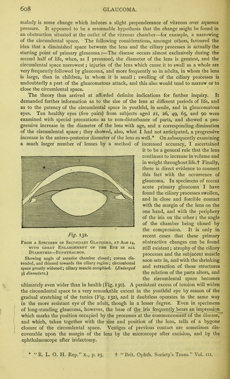 malady is some change which induces a slight preponderance of vitreous over aqueous pressure. It appeared to be a reasonable hypothesis that the change might be found in an obstruction situated at the outlet of the vitreous chamber—for example, a narrowing of the circumlental space. The following considerations, amongst others, favoured the idea that a diminished space between the lens and the ciliary processes is actually the starting point of primary glaucoma :—The disease occurs almost exclusively during the second half of life, when, as I presumed, the diameter of the lens is greatest, and the circumlental space narrowest; injuries of the lens which cause it to swell as a whole are very frequently followed by glaucoma, and more frequently so in adults, in whom the lens is large, than in children, in whom it is small ; swelling of the ciliary processes is undoubtedly a part of the glaucomatous attack, and this also would tend to narrow or to close the circumlental space. The theory thus arrived at afforded definite indications for further inquiry. It demanded further information as to the size of the lens at different periods of life, and as to the patency of the circumlental space in youthful, in senile, and in glaucomatous eyes. Ten healthy eyes (five pairs) from subjects aged 21, 26, 49, 65, and 90 were examined with special precautions as to non-disturbance of parts, and showed a pro- gressive increase in the diameter of the lens with age, and a corresponding diminution of the circumlental space ; they showed, also, what I had not anticipated, a progressive increase in the antero-posterior diameter of the lens as well.* On .subsequently examining a much larger number of lenses by a method of increased accuracy, I ascertained it to be a general rule that the lens continues to increase in volume and in weight throughout life.t Finally, there is direct evidence to connect this fact with the occurrence of glaucoma. In specimens of recent acute primary glaucoma I have found the ciliary processes swollen, and in close and forcible contact with the margin of the lens on the one hand, and with the periphery of the iris on the other; the angle of the chamber being closed by the compression. It is only in recent cases that these primary obstructive changes can be found still existent; atrophy of the ciliary processes and the subjacent muscle soon sets in, and with the shrinking and retraction of these structures the relation of the parts alters, and the circumlental space becomes ultimately even wider than in health (Fig. 130). A persistent excess of tension will widen the circumlental space to a very remarkable extent in the youthful eye by reason of the gradual stretching of the tunics (Fig. 132), and it doubtless operates in the same way in the more resistant eye of the adult, though in a lesser degree. Even in specimens of long-standing glaucoma, however, the base of the iris frequently bears an impression which marks the position occupied by the processes at the commencement of the disease, and which, taken together with the size and position of the lens, tells of a bygone closure of the circumlental space. Vestiges of previous contact are sometimes dis- coverable upon the margin of the lens by the microscope after excision, and by the ophthalmoscope after iridectomy. * R. L. O. H. Rep. X., p. 25. t Brit. Ophth. Society's Trans. Vol. ill. Fig, 132. From a Specimen of Secondary Glaucoma, at Age 14, with great enlargement of the eve in all Diameters—Buphthalmos. Showing angle of anterior chamber closed; cornea dis- tended, and thinned towards the ciliary region ; circumlental space greatly widened; ciliary muscle atrophied. {Enlarged l\ diameters.)