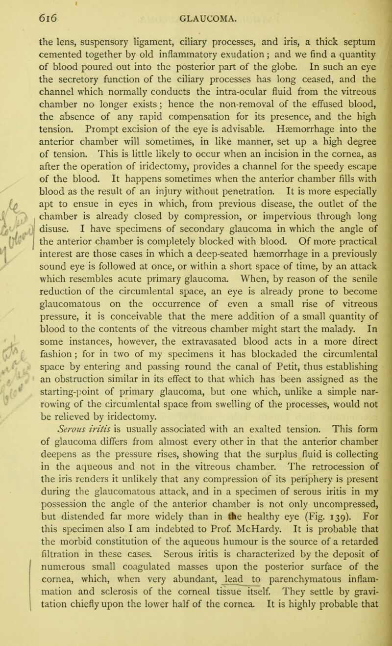 the lens, suspensory ligament, ciliary processes, and iris, a thick septum cemented together by old inflammatory exudation; and we find a quantity of blood poured out into the posterior part of the globe. In such an eye the secretory function of the ciliary processes has long ceased, and the channel which normally conducts the intra-ocular fluid from the vitreous chamber no longer exists; hence the non-removal of the effused blood, the absence of any rapid compensation for its presence, and the high tension. Prompt excision of the eye is advisable. Haemorrhage into the anterior chamber will sometimes, in like manner, set up a high degree of tension. This is little likely to occur when an incision in the cornea, as after the operation of iridectomy, provides a channel for the speedy escape of the blood. It happens sometimes when the anterior chamber fills with blood as the result of an injury without penetration. It is more especially apt to ensue in eyes in which, from previous disease, the outlet of the chamber is already closed by compression, or impervious through long disuse. I have specimens of secondary glaucoma in which the angle of the anterior chamber is completely blocked with blood. Of more practical interest are those cases in which a deep-seated haemorrhage in a previously sound eye is followed at once, or within a short space of time, by an attack which resembles acute primary glaucoma. When, by reason of the senile reduction of the circumlental space, an eye is already prone to become glaucomatous on the occurrence of even a small rise of vitreous pressure, it is conceivable that the mere addition of a small quantity of blood to the contents of the vitreous chamber might start the malady. In some instances, however, the extravasated blood acts in a more direct fashion ; for in two of my specimens it has blockaded the circumlental space by entering and passing round the canal of Petit, thus establishing an obstruction similar in its effect to that which has been assigned as the starting-i^oint of primary glaucoma, but one which, unlike a simple nar- rowing of the circumlental space from swelling of the processes, would not be relieved by iridectomy. Serous iritis is usually associated with an exalted tension. This form of glaucoma differs from almost every other in that the anterior chamber deepens as the pressure rises, showing that the surplus fluid is collecting in the aqueous and not in the vitreous chamber. The retrocession of the iris renders it unlikely that any compression of its periphery is present during the glaucomatous attack, and in a specimen of serous iritis in my possession the angle of the anterior chamber is not only uncompressed, but distended far more widely than in Ae healthy eye (Fig. 139). For this specimen also I am indebted to Prof. McHardy. It is probable that the morbid constitution of the aqueous humour is the source of a retarded filtration in these cases. Serous iritis is characterized by the deposit of numerous small coagulated masses upon the posterior surface of the cornea, which, when very abundant, _lead to parenchymatous inflam- mation and sclerosis of the corneal tissue itself They settle by gravi- tation chiefly upon the lower half of the cornea. It is highly probable that