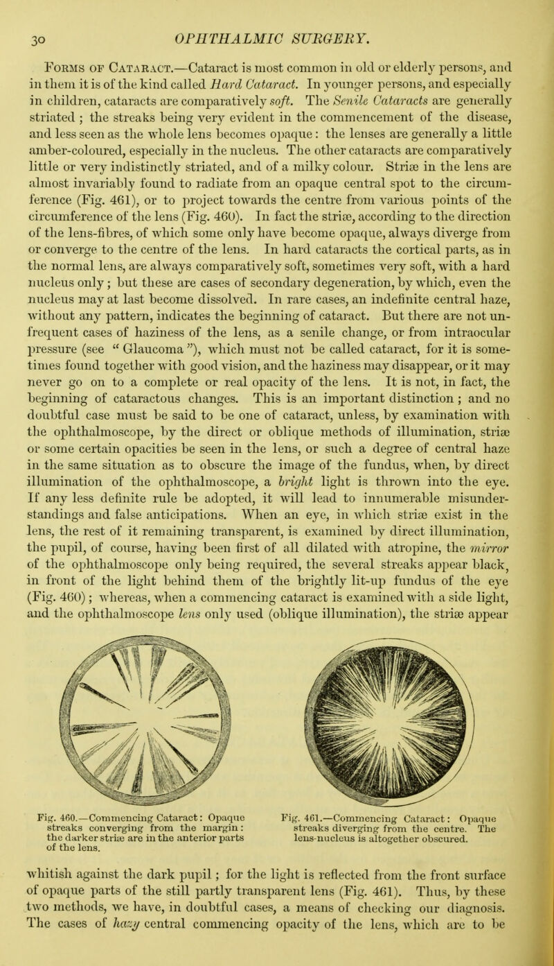 Forms of Cataract.—Cataract is most common in old or elderly person?;, and in tliem it is of the kind called Hard Cataract. In yonnger persons, and especially in children, cataracts are comparatively soft. The Senile Cataracts are generally striated ; the streaks being very evident in the commencement of the disease, and less seen as the whole lens becomes opaque: the lenses are generally a little amber-coloured, especially in the nucleus. The other cataracts are comparatively little or very indistinctly striated, and of a milky colour. Striae in the lens are almost invariably found to radiate from an opaque central spot to the circum- ference (Fig. 461), or to project towards the centre from various points of the circumference of the lens (Fig. 460). In fact the strise, according to the direction of the lens-fibres, of which some only have become opaque, always diverge from or converge to tlie centre of the lens. In hard cataracts the cortical parts, as in the normal lens, are always comparatively soft, sometimes very soft, with a hard nucleus only ; but these are cases of secondary degeneration, by which, even the nucleus may at last become dissolved. In rare cases, an indefinite central haze, without any pattern, indicates the beginning of cataract. But there are not un- frequent cases of haziness of the lens, as a senile change, or from intraocular pressure (see  Glaucoma ), which must not be called cataract, for it is some- times found together with good vision, and the haziness may disappear, or it may never go on to a complete or real opacity of the lens. It is not, in fact, the beginning of cataractous changes. This is an important distinction ; and no doubtful case must be said to be one of cataract, unless, by examination with the ophthalmoscope, by the direct or oblique methods of illumination, striae or some certain opacities be seen in the lens, or such a degree of central haze in the same situation as to obscure the image of the fundus, when, by direct illumination of the ophthalmoscope, a bright light is thrown into the eye. If any less definite rule be adopted, it will lead to innumerable misunder- standings and false anticipations. When an eye, in which striae exist in the lens, the rest of it remaining transparent, is examined by direct illumination, the pupil, of course, having been first of all dilated with atropine, the mirror of the ophthalmoscope only being required, the several streaks appear black, in front of the light behind them of the brightly lit-up fundus of the eye (Fig. 460); whereas, when a commencing cataract is examined witli a side light, and the ophthalmoscope lens only used (oblique illumination), the striae appear Fitf. 460.—Commencing Cataract: Opaque Fig. 461.—Commencing Cataract: Opaque streaks converging from the margin: streaks diverging from the centre. The the darker striaj are in the anterior parts lens-nuclevis is altogether obscui-ed. of the lens. whitish against the dark pupil; for the light is reflected from the front surface of opaque parts of the still partly transparent lens (Fig. 461). Thus, by these two methods, we have, in doubtful cases, a means of checking our diagnosis. The cases of hazi/ central commencing opacity of the lens, which are to be