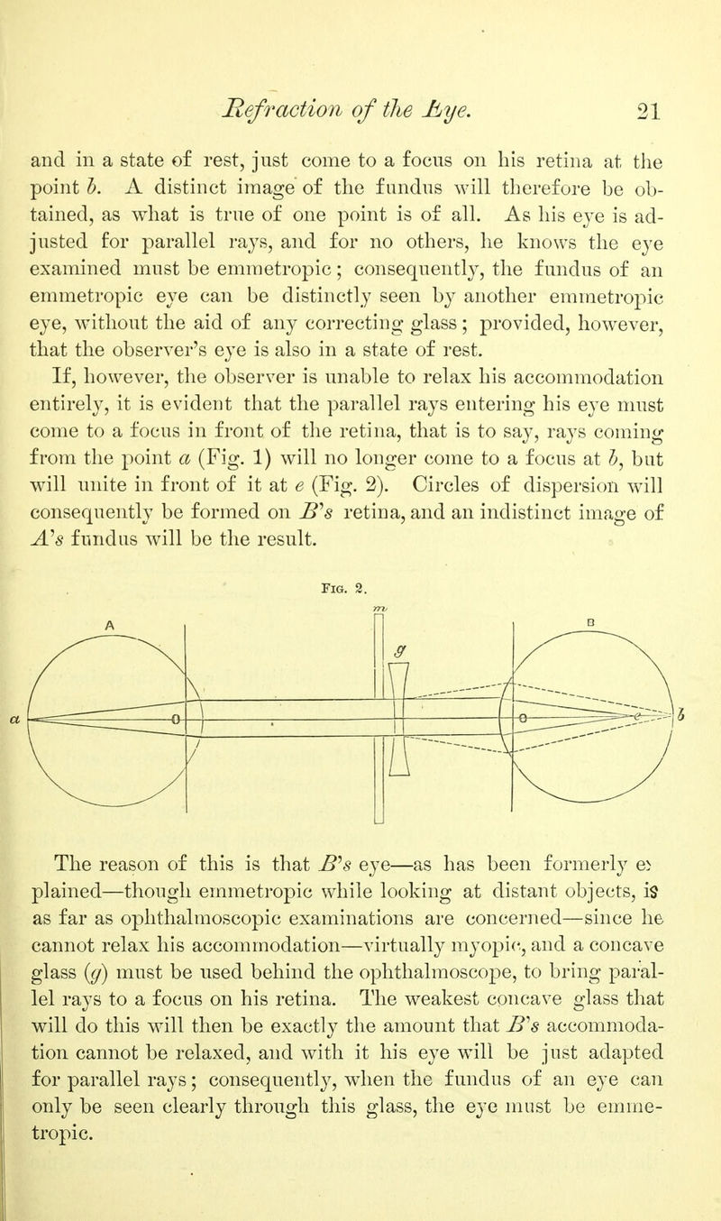 and in a state of rest, just come to a focus on his retina at the point h. A distinct image of the fundus will therefore be ob- tained, as what is true of one point is of all. As his ej^e is ad- justed for parallel rays, and for no others, he knows the eye examined must be emmetropic; consequently, the fundus of an emmetropic eye can be distinctly seen by another emmetropic eye, without the aid of any correcting glass; provided, however, that the observer's eye is also in a state of rest. If, however, the observer is unable to relax his accommodation entirely, it is evident that the parallel rays entering his eye must come to a focus in front of the retina, that is to say, rays coming from the point a (Fig. 1) will no longer come to a focus at 5, but will unite in front of it at e (Fig. 2). Circles of dispersion will consequently be formed on B''s retina, and an indistinct image of A^s fundus will be the result. Fig. 2. The reason of this is that B^s eye—as has been formerly e> plained—though emmetropic while looking at distant objects, is as far as ophthalmoscopic examinations are concerned—since he cannot relax his accommodation—virtually myopic, and a concave glass ((j) must be used behind the ophthalmoscope, to bring paral- lel rays to a focus on his retina. The weakest concave glass that will do this will then be exactly the amount that B^s accommoda- tion cannot be relaxed, and with it his eye w^ill be just adapted for parallel rays; consequently, when the fundus of an eye can only be seen clearly through this glass, the eye must be emme- tropic.