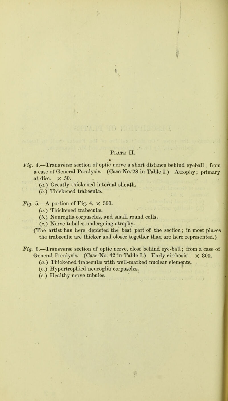 Fig. 4.—Transverse section of optic nerve a sliori distance behind eyeball; from a case of General Paralysis. (Case No. 28 in Table I.) Atrophy; primary at disc. X 50. (a.) Greatly thickened internal sheath. (6.) Thickened trabeculse. Fig. 5.—A portion of Fig. 4, X 300. (a.) Thickened trabeculae. (6.) Neuroglia corpuscles, and small round cells. (e.) Nerve tubules undergoing atrophy. (The artist has here depicted the best part of the section; in most places the trabeculse are thicker and closer together than are here represented.) Fig. 6.—Transverse section of optic nerve, close behind eye-ball; from a case of General Paralysis. (Case No. 42 in Table I.) Early cirrhosis, x 300. (a.) Thickened trabeculse with well-marked nuclear elemejnts. (h.) Hypertrophied neuroglia corpuscles, (c.) Healthy nerve tubules.