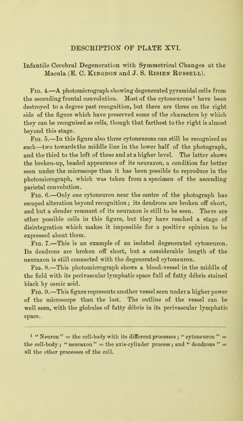 Infantile Cerebral Degeneration with Symmetrical Changes at the Macula (E. C. Kingdon and J. S. Risien Russell). Fig. 4.—A photomicrograph showing degenerated pyramidal cells from the ascending frontal convolution. Most of the cytoneurons * have been destroyed to a degree past recognition, but there are three on the right side of the figure which have preserved some of the characters by which they can be recognised as cells, though that farthest to the right is almost beyond this stage. Fig. 5.—In this figure also three cytoneurons can still be recognised as such—two towards the middle line in the lower half of the photograph, and the third to the left of these and at a higher level. The latter shows the broken-up, beaded appearance of its neuraxon, a condition far better seen under the microscope than it has been possible to reproduce in the photomicrograph, which was taken from a specimen of the ascending parietal convolution. Fig. 6.—Only one cytoneuron near the centre of the photograph has escaped alteration beyond recognition ; its dendrons are broken ofE short, and but a slender remnant of its neuraxon is still to be seen. There are other possible cells in this figure, but they have reached a stage of disintegration which makes it impossible for a positive opinion to be expressed about them. Fig. 7.—This is an example of an isolated degenerated cytoneuron. Its dendrons are broken off short, but a considerable length of the neuraxon is still connected with the degenerated cytoneuron. Fig. 8.—This photomicrograph shows a blood-vessel in the middle of the field with its perivascular lymphatic space full of fatty debris stained black by osmic acid. Fig. 9.—This figure represents another vessel seen under a higher power of the microscope than the last. The outline of the vessel can be well seen, with the globules of fatty debris in its perivascular lymphatic space. ^ Neuron = the cell-body with its different processes j *' cytoueurou  = the cell-body ;  neuraxon  = the axis-cylinder process ; and  dendrons  = all the other processes of the cell.