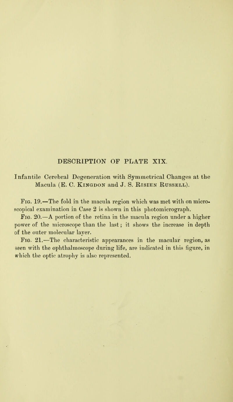 Infantile Cerebral Degeneration with Symmetrical Changes at the Macula (E. C. Kingdon and J. S. Risien Russell). Fig. 19.—The fold in the macula region which was met with on micro- scopical examination in Case 2 is shown in this photomicrograph. Fig. 20.—A portion of the retina in the macula region under a higher power of the microscope than the last; it shows the increase in depth of the outer molecular layer. Fig. 21.—The characteristic appearances in the macular region, as seen with the ophthalmoscope during life, are indicated in this figure, in «vhich the optic atropliy is also represented.