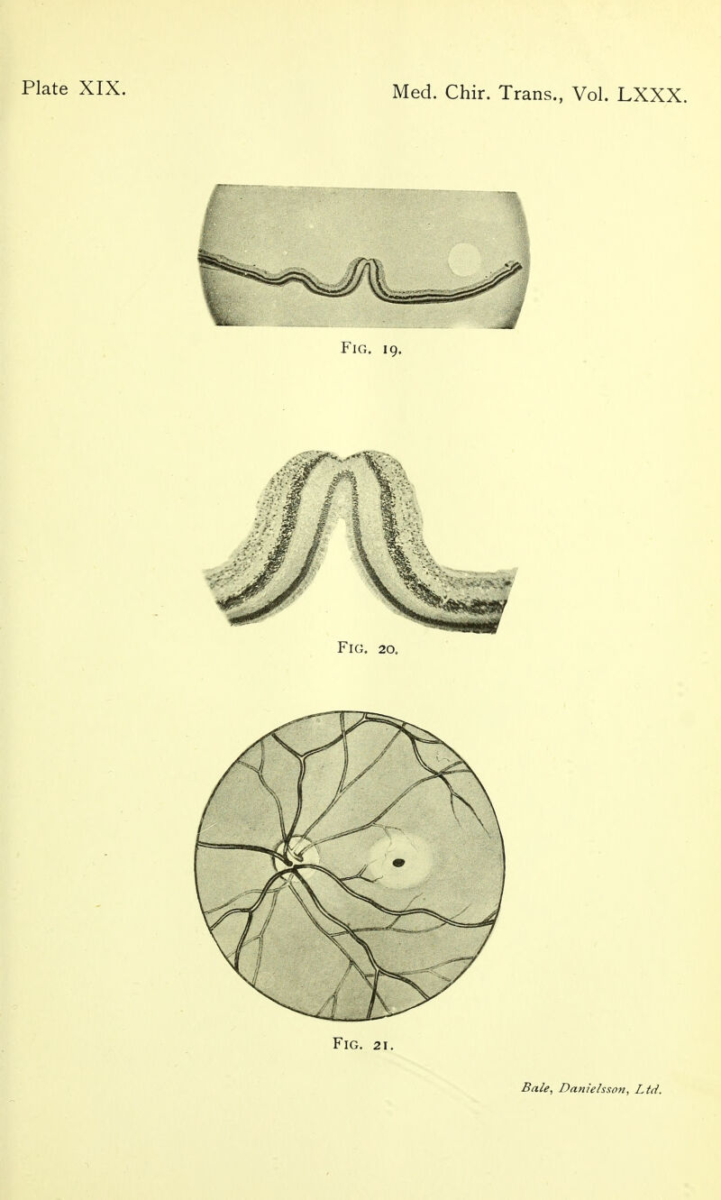 Med. Chir. Trans., Vol. LXXX. Fig. 21.