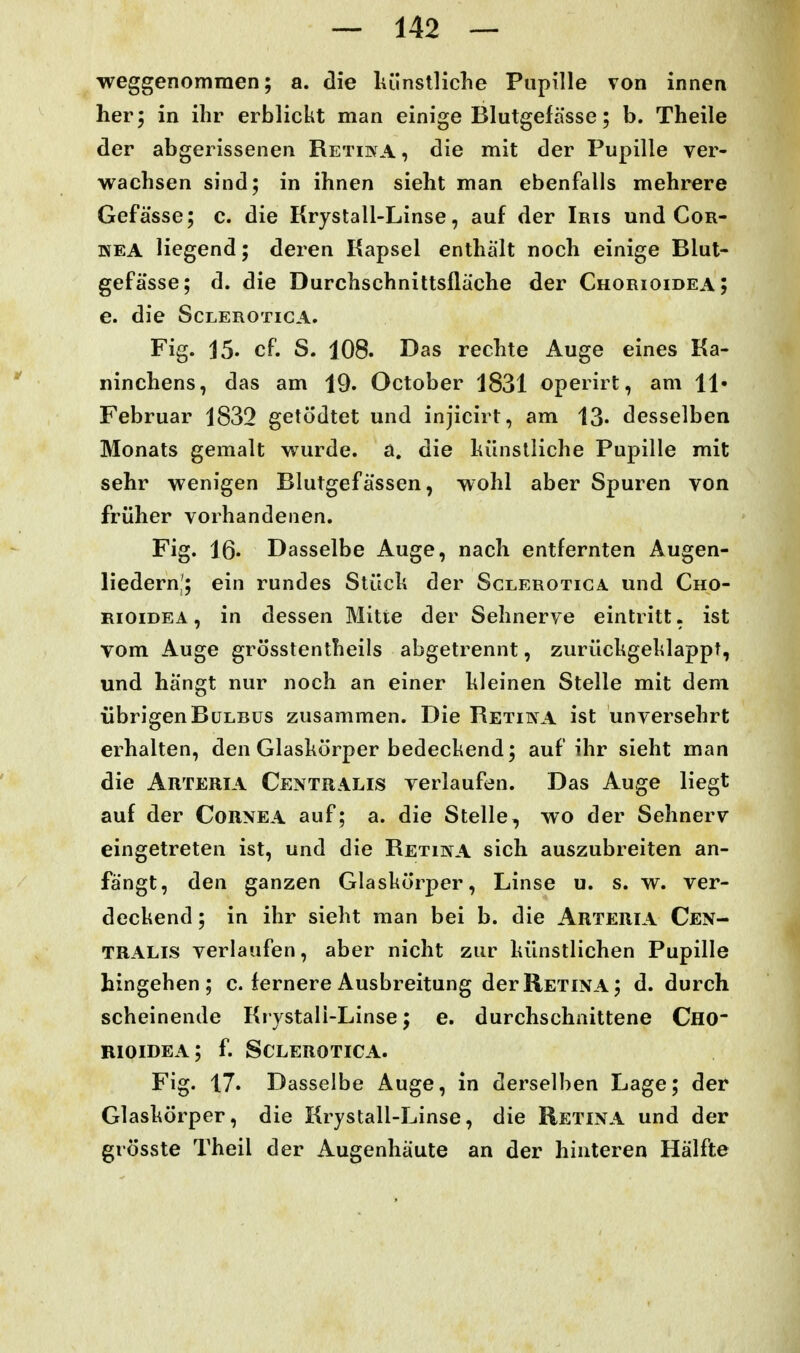 weggenommen; a. die liünslliche Pupille von innen her; in ihr erblickt man einige Blutgefässe; b. Theile der abgerissenen Retina , die mit der Pupille ver- wachsen sind; in ihnen sieht man ebenfalls mehrere Gefä'sse; c. die Krystall-Linse, auf der Iris und Cor- nea liegend; deren Kapsel enthält noch einige Blut- gefässe; d. die Durchschnittsfläche der Chorioidea; e. die Sclerotica. Fig. J5. cf. S. 108. Das rechte Auge eines Ka- ninchens, das am 19. October 1831 operirt, am 11» Februar 1832 getödtet und injicirt, am 13. desselben Monats gemalt wurde, a. die liünslliche Pupille mit sehr wenigen Blutgefässen, wohl aber Spuren von früher vorhandenen. Fig. 16« Dasselbe Auge, nach entfernten Augen- liedern!; ein rundes Stück der Sclerotica. und Cho- rioidea , in dessen Mitte der Sehnerve eintritt, ist vom Auge grösstentheils abgetrennt, zurückgeklappt, und hängt nur noch an einer kleinen Stelle mit dem übrigen Bulbus zusammen. Die Retiiya ist unversehrt erhalten, den Glaskörper bedeckend; auf ihr sieht man die Arteria Centralis verlaufen. Das Auge liegt auf der Cornea auf; a. die Stelle, wo der Sehnerv eingetreten ist, und die Retina sich auszubreiten an- fängt, den ganzen Glaskörper, Linse u. s. w. ver- deckend ; in ihr sieht man bei b. die Arteria Cen- tralis verlaufen, aber nicht zur künstlichen Pupille hingehen; c. fernere Ausbreitung der Retina ; d. durch scheinende Krystali-Linse; e. durchschnittene Cho- rioidea; f. Sclerotica. Fig. 17. Dasselbe Auge, in derselben Lage; der Glaskörper, die Krystall-Linse, die Retina und der grösste Theil der Augenhäute an der hinteren Hälfte