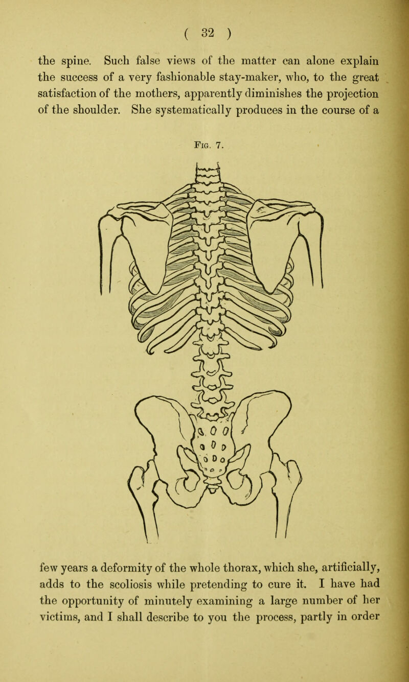 the spine. Such false views of the matter can alone explain the success of a very fashionable stay-maker, who, to the great satisfaction of the mothers, apparently diminishes the projection of the shoulder. She systematically produces in the course of a Fig. 7. few years a deformity of the whole thorax, which she, artificially, adds to the scoliosis while pretending to cure it. I have had the opportunity of minutely examining a large number of her victims, and I shall describe to you the process, partly in order