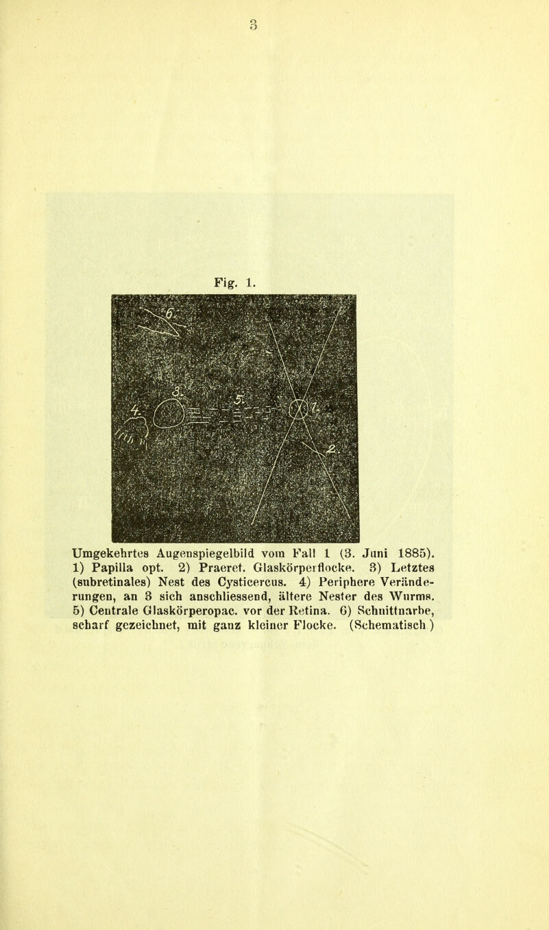 Fig. 1. Umgekehrtes Augenspiegelbild vom Fal! 1 (3. Juni 1885). 1) Papilla opt. 2) Praeret. Glaskörpeiflocke. 3) Letztes (subretinales) Nest des Cysticercus. 4) Periphere Verände- rungen, an 3 sich anschliessend, ältere Nester des Wurms. 5) Centrale Glaskörperopac. vor der Retina. 6) Schnittnarbe, scharf gezeichnet, mit ganz kleiner Flocke. (Schematisch)