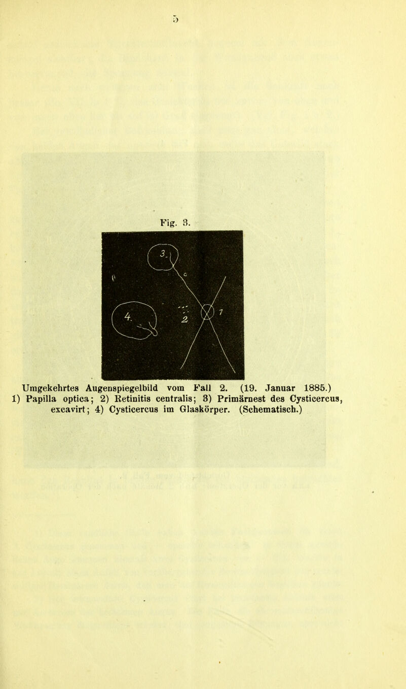 Fig. 3. Umgekehrtes Augenspiegelbild vom Fall 2. (19. Januar 1885.) 1) Papilla optica; 2) Retinitis centralis; 3) Primärnest des Cysticercus, excavirt; 4) Cysticercus im Glaskörper. (Schematisch.)