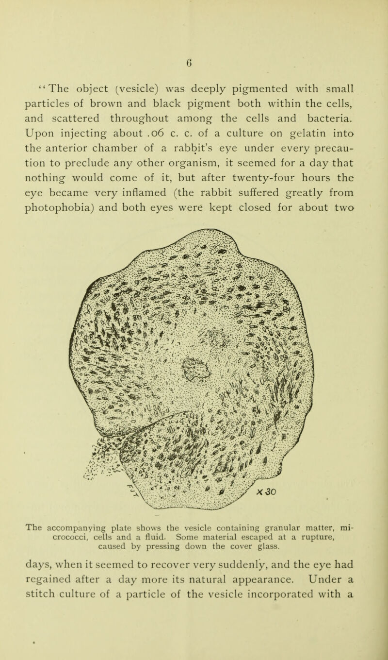 The object (vesicle) was deeply pigmented with small particles of brown and black pigment both within the cells, and scattered throughout among the cells and bacteria. Upon injecting about .06 c. c. of a culture on gelatin into the anterior chamber of a rabbit's eye under every precau- tion to preclude any other organism, it seemed for a day that nothing would come of it, but after twenty-four hours the eye became very inflamed (the rabbit suffered greatly from photophobia) and both eyes were kept closed for about two The accompanying plate shows the vesicle containing granular matter, mi- crococci, cells and a fluid. Some material escaped at a rupture, caused by pressing down the cover glass. days, when it seemed to recover very suddenly, and the eye had regained after a day more its natural appearance. Under a stitch culture of a particle of the vesicle incorporated with a