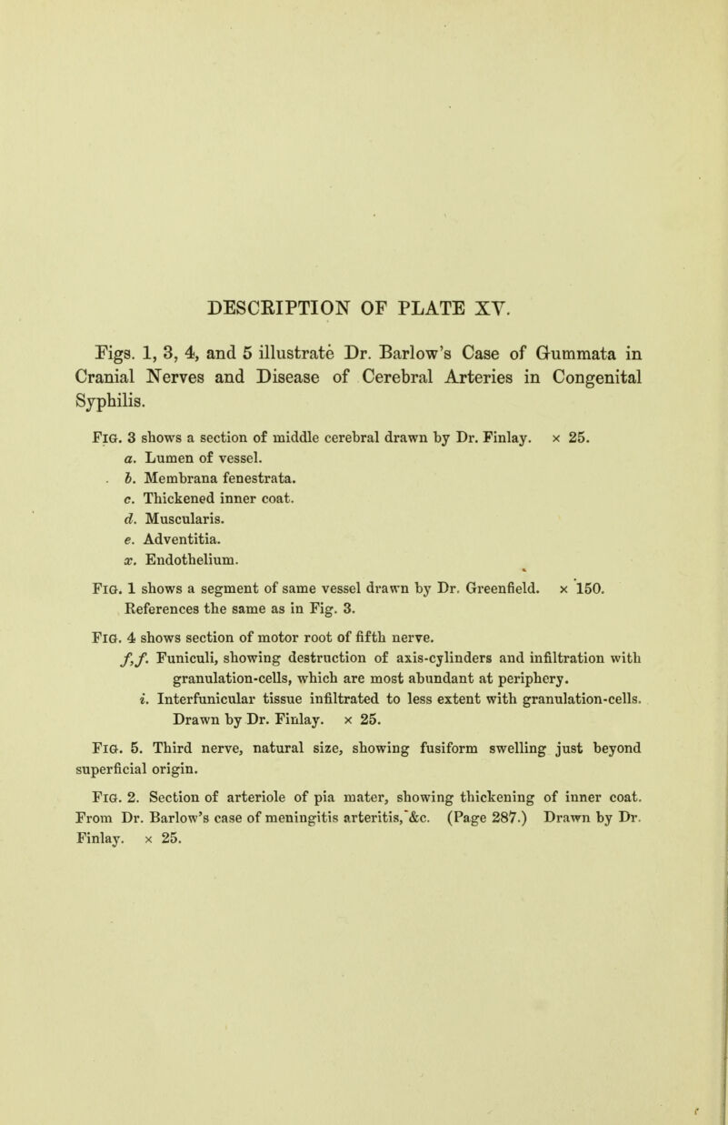 DESCRIPTION OF PLATE XY. Figs. 1, 3, 4, and 5 illustrate Dr. Barlow's Case of Gummata in Cranial Nerves and Disease of Cerebral Arteries in Congenital Syphilis. Fig. 3 shows a section of middle cerebral drawn by Dr. Finlay. x 25. a. Lumen of vessel. h. Membrana fenestrata. c. Thickened inner coat. d. Muscularis. e. Adventitia. X. Endothelium. Fig. 1 shows a segment of same vessel drawn by Dr. Greenfield, x 150. References the same as in Fig. 3. Fig. 4 shows section of motor root of fifth nerve. f. f. Funiculi, showing destruction of axis-cylinders and infiltration with granulation-cells, which are most abundant at periphery. i. Interfunicular tissue infiltrated to less extent with granulation-cells. Drawn by Dr. Finlay. x 25. Fig. 5. Third nerve, natural size, showing fusiform swelling just beyond superficial origin. Fig. 2. Section of arteriole of pia mater, showing thickening of inner coat. From Dr. Barlow's case of meningitis arteritis,&e. (Page 287.) Drawn by Dr. Finlay. x 25.