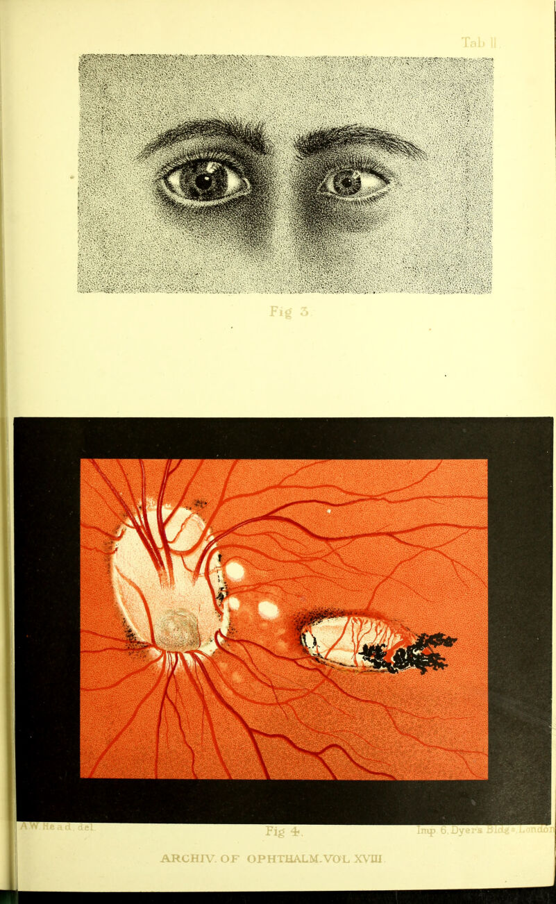 m i m nip. 6, Dye ARCHAT. OF OPHTHALM,VOL XVIU