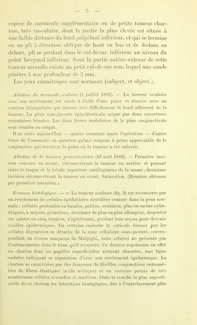 espèce de caroncule supplémentaire ou de petite tumeur char- nue, très vasculaire, dont la partie la plus élevée est située à une faible distance du bord palpébral inférieur, et qui se termine en un pli à direction oblique de haut en bas et de dedans en dehors, pli se perdant dans le cul-de-sac inférieur au niveau du p«»iiit lacrymal inférieur. Sous la partie antéro-externe de cette tumeur arrondie existe un petit cul-de-sac sous lequel une sonde pénètre à une profondeur de 2 mm. Les yeux emmétropes sont normaux (subject. et object.). Ablation du dermoïde oculaire (1 juillet 1882). — La tumeur oculaire avec son revêtement est saisie à l'aide d'une pince et abrasée avec un couteau triangulaire qui entame très difficilement le bord adhérent de la tumeur. La plaie sous-jacente épiscléroticale saigne par deux ouvertures vasculaires branles. Los deux lèvres mobilisées de la plaie conjonctivale sont réunies au catgut. 11 ne reste aujourd'hui — quatre semaines après l'opération — d'autre trace de l'anomalie en question qu'une rougeur à peine appréciable de la conjonctive qui recouvre le point où la tumeur a été enlevée. Ablation de la tumeur préauriculaire (16 août 1882). — Première inci- sion concave en avant, circonscrivant la tumeur en arrière et passant entre le tragus et le lobule supérieur cartilagineux de la masse; deuxième incision circonscrivant la tumeur en avant. Suturation. (Réunion obtenue par première intention.) Examen hîstologiqué. — a) La tumeur oculaire (fig. 2) est recouverte par un revêtement de cellules épithéliales stratifiées comme dans la peau nor- male : cellules profondes ou basâtes, petites, ovalaires, plus ou moins cylin- driques, à noyaux granuleux, devenant déplus en plus allongées, disposées sur quatre ou cinq rangées, s'aplatissant, perdant leur noyau pour devenir écailles épidermiques. En certains endroits la cuticule formée par les cellules dégénérées se détache de la zone cellulaire sous-jacente, corres- pondant au réseau muqueux de Malpighi, mais celui-ci ne présente pas d'enfoncements dans le tissu qu'il recouvre. Ce dernier représente en effet un chorion dont les papilles superficielles seraient absentes, une ligne ondulée indiquant sa séparation d'avec son revêtement épidermique. Le chorion se caractérise par des faisceaux de fibrilles conjonctives entremê- lées de fibres élastiques (acide acétique) et en certains points de très nombreuses cellules arrondies et nucléées. Danj la couche la plus superfi- cielle de ce chorion les interstices losangiques, dus à l'entrelacement plus