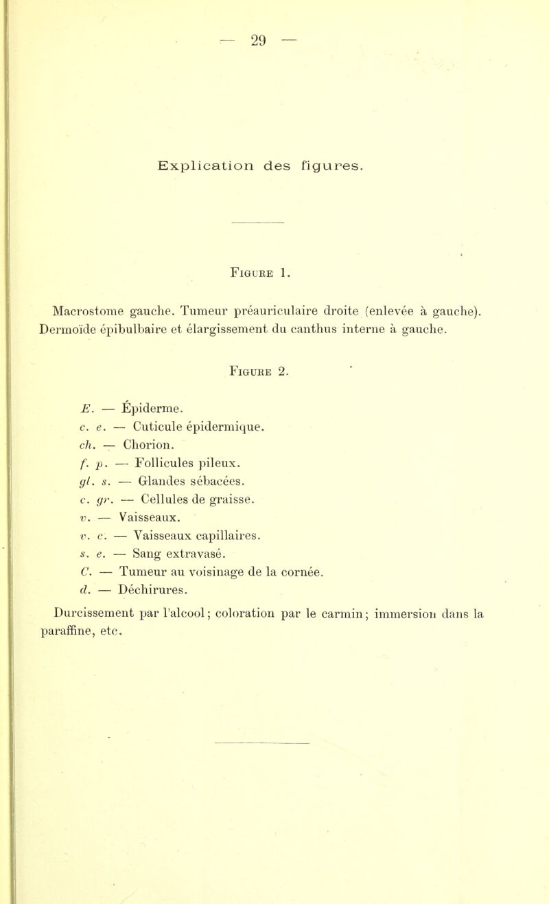 29 — Explication des figures. Figure 1. Macrostome gauche. Tumeur préauriculaire droite (enlevée à gauche). Dermoïde épibulbaire et élargissement du canthus interne à gauche. Figure 2. E. — Épiderme. ce. — Cuticule épidermique. ch. — Chorion. f. p. — Follicules pileux. gl. s. — Glandes sébacées. c. gr. — Cellules de graisse. v. — Vaisseaux. v. c. — Vaisseaux capillaires. s. e. — Sang extravasé. C. — Tumeur au voisinage de la cornée. d. — Déchirures. Durcissement par l'alcool ; coloration par le carmin ; immersion dans la paraffine, etc.