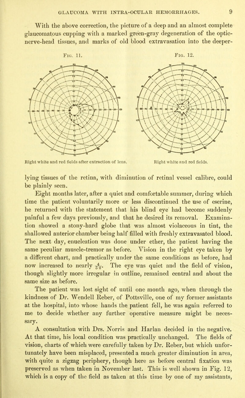 With the above correction, the picture of a deep and an almost complete glaucomatous cu})ping with a marked green-gray degeneration of the optic- nerve-head tissues, and marks of old blood extravasation into the deeper- FiG. 11. Fig. 12. Right white and red fields after extraction of lens. Right white and red fields. lying tissues of the retina, with diminution of retinal vessel calibre, could be plainly seen. Eight months later, after a quiet and comfortable summer, during which time the patient voluntarily more or less discontinued the use of eserine, he returned with the statement that his blind eye had become suddenly painful a few days previously, and that he desired its removal. Examina- tion showed a stony-hard globe that was almost violaceous in tint, the shallowed anterior chamber being half filled with freshly extravasated blood. The next day, enucleation was done under ether, the patient having the same peculiar muscle-tremor as before. Vision in the right eye taken by a different chart, and practically under the same conditions as before, had now increased to nearly The eye was quiet and the field of vision, though slightly more irregular in outline, remained central and about the same size as before. The patient was lost sight of until one month ago, when through the kindness of Dr. Wendell Reber, of Pottsville, one of my former assistants at the hospital, into whose hands the patient fell, he was again referred to me to decide whether any further operative measure might be neces- sary. A consultation with Drs. Norris and Harlan decided in the negative. At that time, his local condition was practically unchanged. The fields of vision, charts of which were carefully taken by Dr. Reber, but which unfor- tunately have been misplaced, presented a much greater diminution in area, with quite a zigzag periphery, though here as before central fixation was preserved as when taken in November last. This is well shown in Fig. 12, which is a copy of the field as taken at this time by one of my assistants.