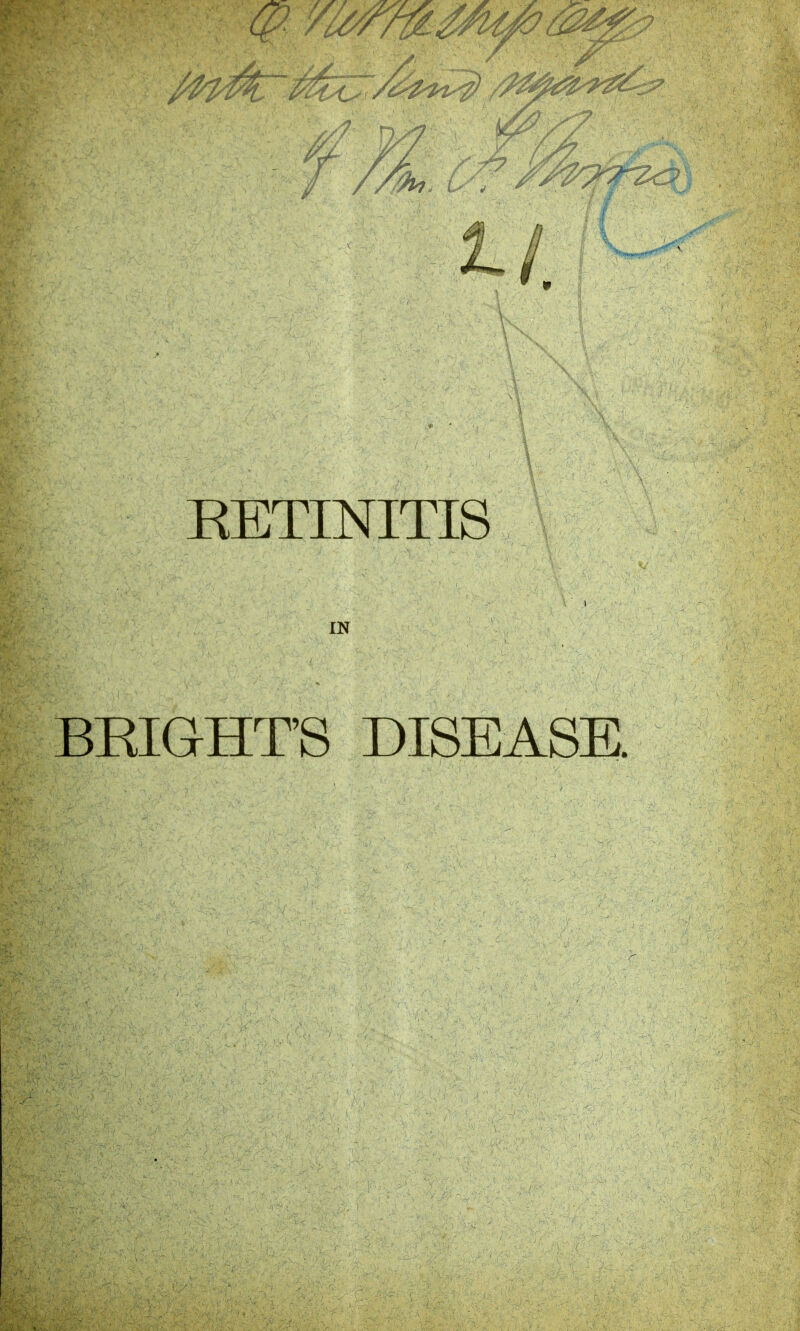 RETINITIS IN