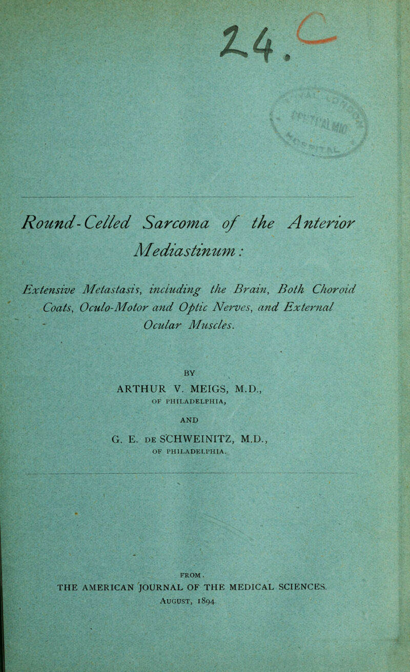 Round'Celled Sarcoma of the Anterior Mediastinum: Extensive Metastasis, including the Brain, Both Choroid Coats, Oculo-Motor and Optic Nerves, and External Ocular Muscles. BY ARTHUR V. MEIGS, M.D., OF PHILADELPHIA, AND G. E. DE SCHWEINITZ, M.D., OF PHILADELPHIA. FROM . THE AMERICAN JOURNAL OF THE MEDICAL SCIENCES. August, 1894.