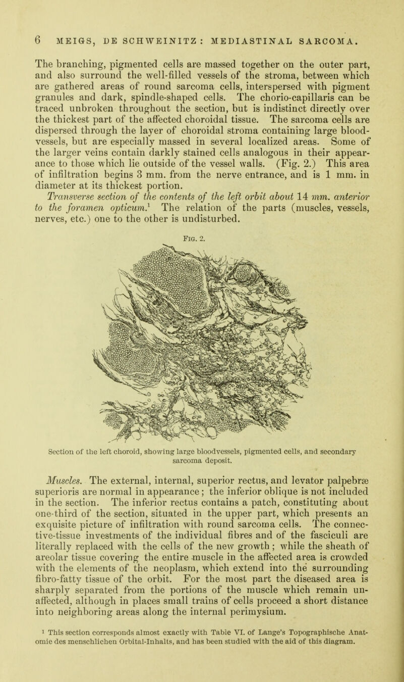 The branching, pigmented cells are massed together on the outer part, and also surround the well-filled vessels of the stroma, between which are gathered areas of round sarcoma cells, interspersed with pigment granules and dark, spindle-shaped cells. The chorio-capillaris can be traced unbroken throughout the section, but is indistinct directly over the thickest part of the affected choroidal tissue. The sarcoma cells are dispersed through the layer of choroidal stroma containing large blood- vessels, but are especially massed in several localized areas. Some of the larger veins contain darkly stained cells analogous in their appear- ance to those which lie outside of the vessel walls. (Fig. 2.) This area of infiltration begins 3 mm. from the nerve entrance, and is 1 mm. in diameter at its thickest portion. Transverse section of the contents of the left orbit about 14 mm. anterior to the foramen opticum} The relation of the parts (muscles, vessels, nerves, etc.) one to the other is undisturbed. Fig. 2. Section of the left choroid, showing large bloodvessels, pigmented cells, and secondary sarcoma deposit. Muscles. The external, internal, superior rectus, and levator palpebrse superioris are normal in appearance; the inferior oblique is not included in the section. The inferior rectus contains a patch, constituting about one-third of the section, situated in the upper part, which presents an exquisite picture of infiltration with round sarcoma cells. The connec- tive-tissue investments of the individual fibres and of the fasciculi are literally replaced with the cells of the new growth ; while the sheath of areolar tissue covering the entire -muscle in the affected area is crowded with the elements of the neoplasm, which extend into the surrounding fibro-fatty tissue of the orbit. For the most part the diseased area is sharply separated from the portions of the muscle which remain un- affected, although in places small trains of cells proceed a short distance into neighboring areas along the internal perimysium. 1 This section corresponds almost exactly with Table VI. of Lange's Topographische Anat- omic des menschlichen Orbital-Inhalts, and has been studied with the aid of this diagram.