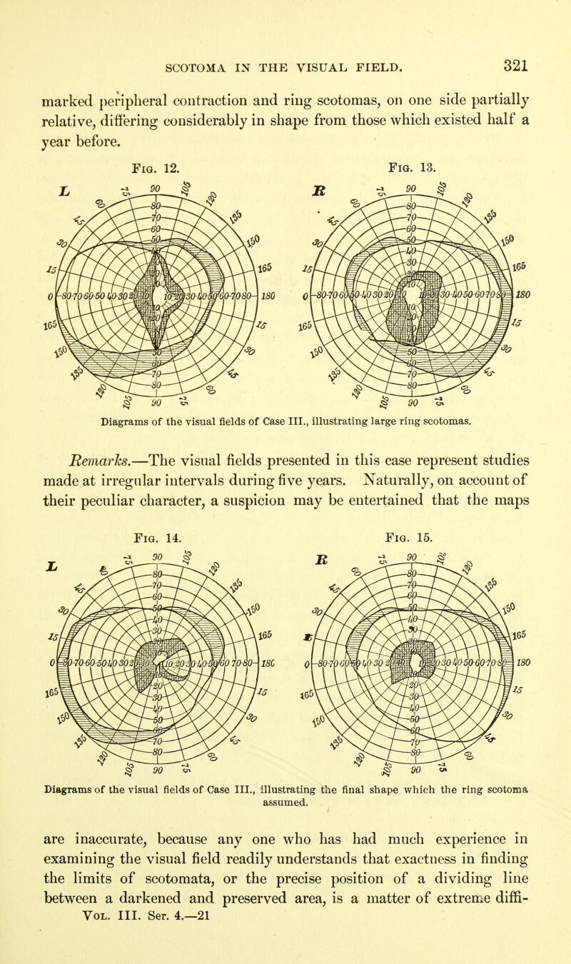 marked peripheral contraction and ring scotomas, on one side partially relative, differing considerably in shape from those which existed half a year before. Fig. 12. Fig. 13. Diagrams of the visual fields of Case III., illustrating large ring scotomas. Remarks.—The visual fields presented in this case represent studies made at irregular intervals during five years. Naturally, on account of their peculiar character, a suspicion may be entertained that the maps Fig. 14. Fig. 15. Diagrams of the visual fields of Case III., illustrating the final shape which the ring scotoma assumed. are inaccurate, because any one who has had much experience in examining the visual field readily understands that exactness in finding the limits of scotomata, or the precise position of a dividing line between a darkened and preserved area, is a matter of extreme diffi- Vol. III. Ser. 4.—21