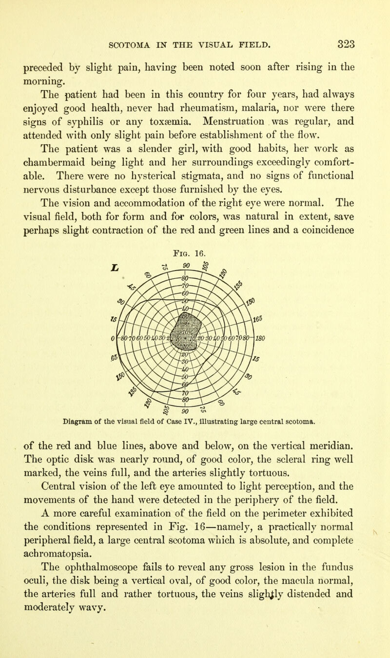 preceded by slight pain, having been noted soon after rising in the morning. The patient had been in this country for four years, had always enjoyed good health, never had rheumatism, malaria, nor were there signs of syphilis or any toxsemia. Menstruation was regular, and attended with only slight pain before establishment of the flow. The patient was a slender girl, with good habits, her work as chambermaid being light and her surroundings exceedingly comfort- able. There were no hysterical stigmata, and no signs of functional nervous disturbance except those furnished by the eyes. The vision and accommodation of the right eye were normal. The visual field, both for form and for colors, was natural in extent, save perhaps slight contraction of the red and green lines and a coincidence Fig. 16. Diagram of the visual field of Case IV., illustrating large central scotoma. of the red and blue lines, above and below, on the vertical meridian. The optic disk was nearly round, of good color, the scleral ring well marked, the veins full, and the arteries slightly tortuous. Central vision of the left eye amounted to light perception, and the movements of the hand were detected in the periphery of the field. A more careful examination of the field on the perimeter exhibited the conditions represented in Fig. 16—namely, a practically normal peripheral field, a large central scotoma which is absolute, and complete achromatopsia. The ophthalmoscope fails to reveal any gross lesion in the fundus oculi, the disk being a vertical oval, of good color, the macula normal, the arteries full and rather tortuous, the veins slightly distended and moderately wavy.