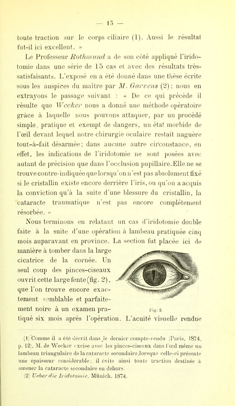 — 15 — toute traction sur le corps çiliaire (1). Aussi le résultat fut-il ici excellent. » Le Professeur Rothmund a de son côté appliqué Lirido- tomie dans une série de 15 cas et avec des résultats très- satisfaisants. L'exposé en a été donné dans une thèse écrite sous les auspices du maître par M. Garvens (2); nous en extrayons le passage suivant : « De ce qui précède il résulte que Wecker nous a donné une méthode opératoire grâce à laquelle nous pouvons attaquer, par un procédé simple, pratique et exempt de dangers, un état morbide de l'œil devant lequel notre chirurgie oculaire restait naguère tout-à-fait désarmée; dans aucune autre circonstance, en effet, les indications de l'iridotomie ne sont posées avec autant de précision que dans l'occlusion pupillaire.Elle ne se trouve contre- indiquée que lorsqu'on n'est pas absolument fixé si le cristallin existe encore derrière l'iris, ou qu'on a acquis la conviction qu'à la suite d'une blessure du cristallin, la cataracte traumatique n'est pas encore complètement résorbée. » Nous terminons en relatant un cas d'iridotomie double faite à la suite d'une opération à lambeau pratiquée cinq mois auparavant en province. La section fut placée ici dp manière à tomber dans la large cicatrice de la cornée. Un seul coup des pinces-ciseaux ouvrit cette large fente (fig. 2), que l'on trouve encore exac- tement semblable et parfaite- ment noire à un examen pra- Fig. % tiqué six mois après l'opération. L'acuité visuelle rendue (1) Comme il a été décrit dans %le dernier compte-rendu (Paris, 1874, p. 12), M. de Wecker < xcise avec les pinces-ciseaux dans l'œil même un lambeau triangulaire de la cataracte secondaire,lorsque celle-ci présente une épaisseur considérable; il évite ainsi toute traction destinée à amener la cataracte secondaire en dehors. (2) Ueber die Iridotomie, Munich, 1874.